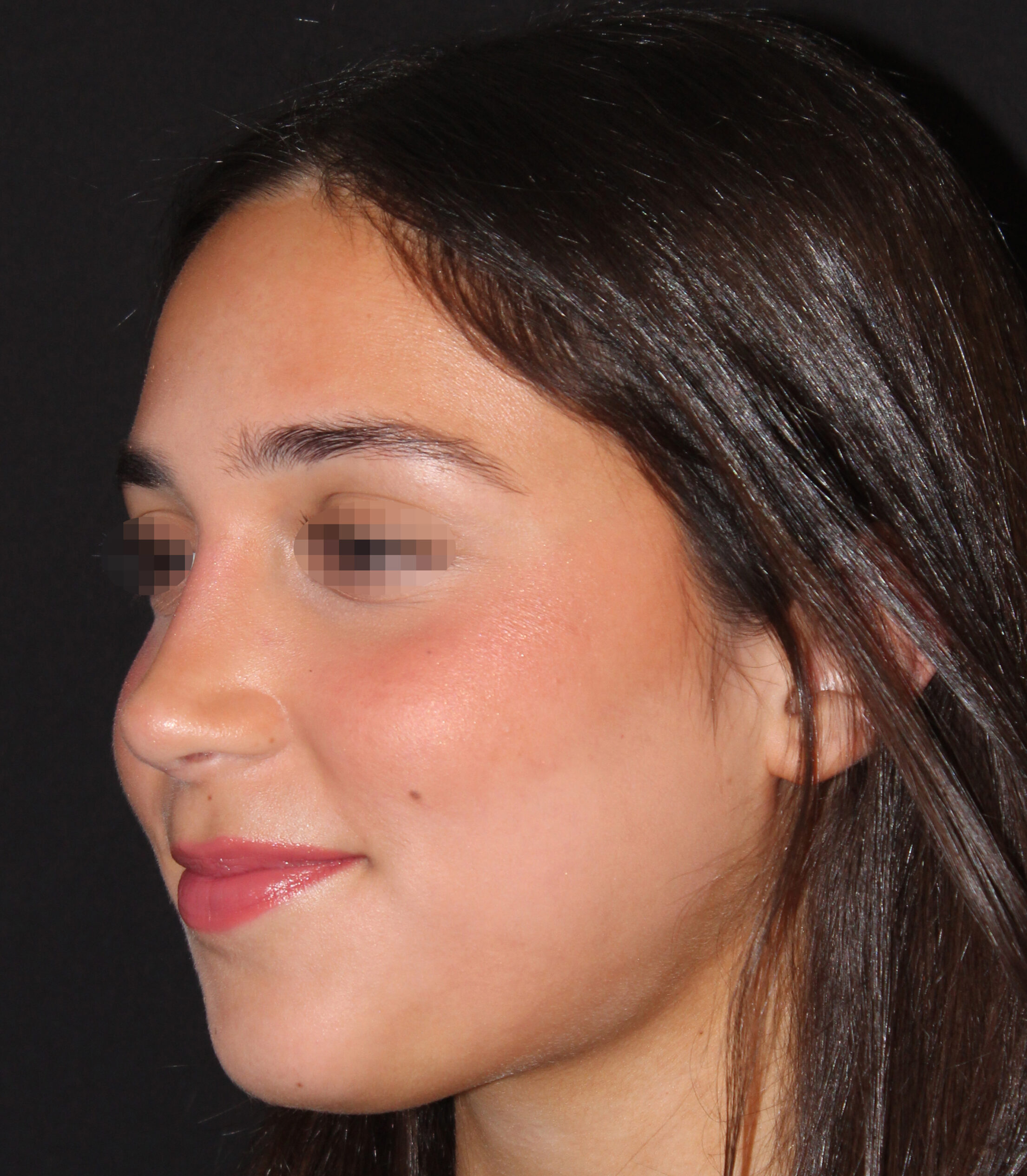 Patient #183 After Image