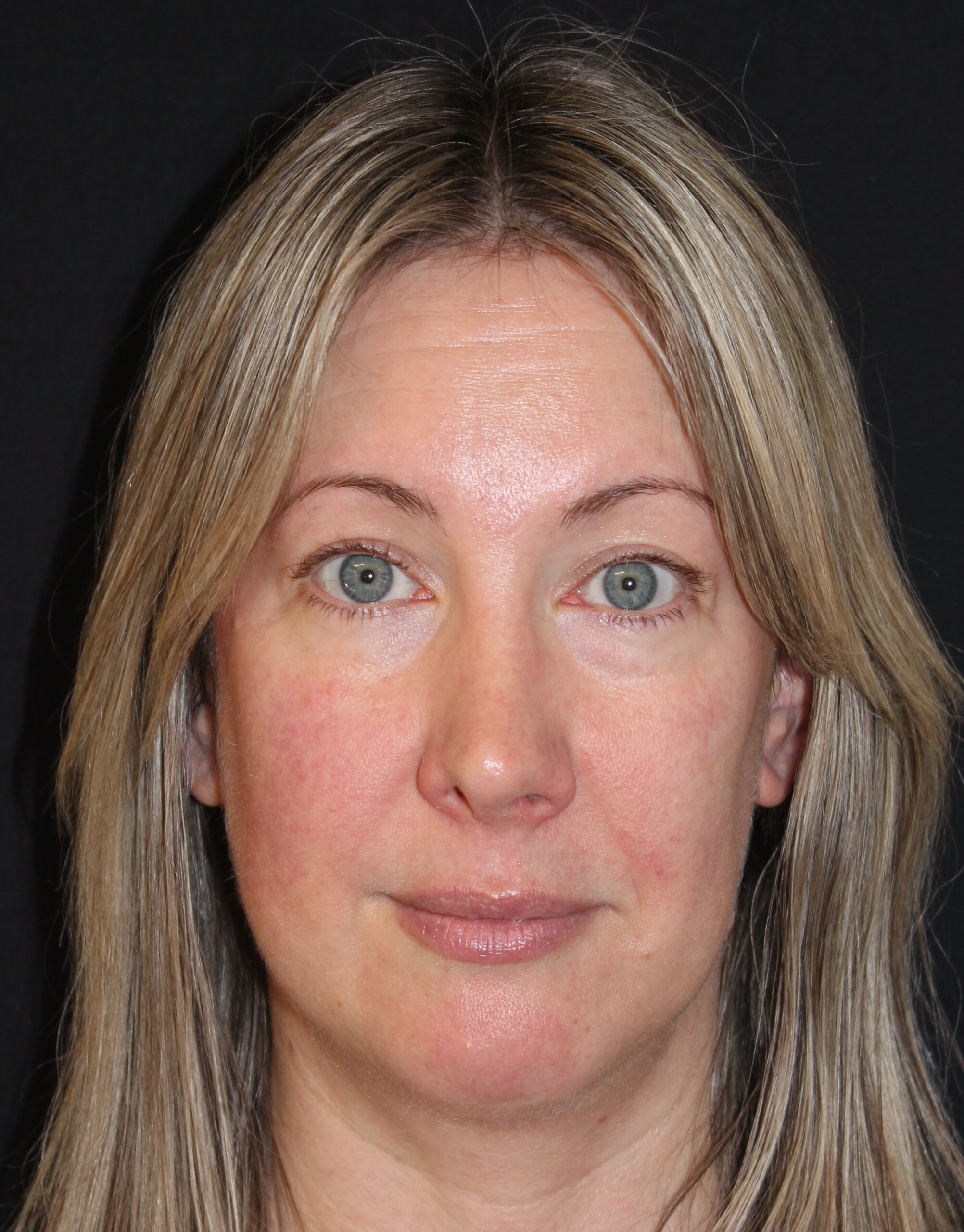 Patient 105 Before Image