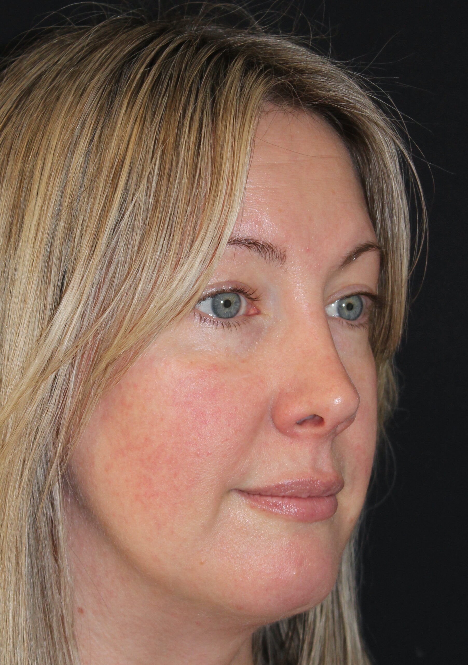 Patient 105 Before Image