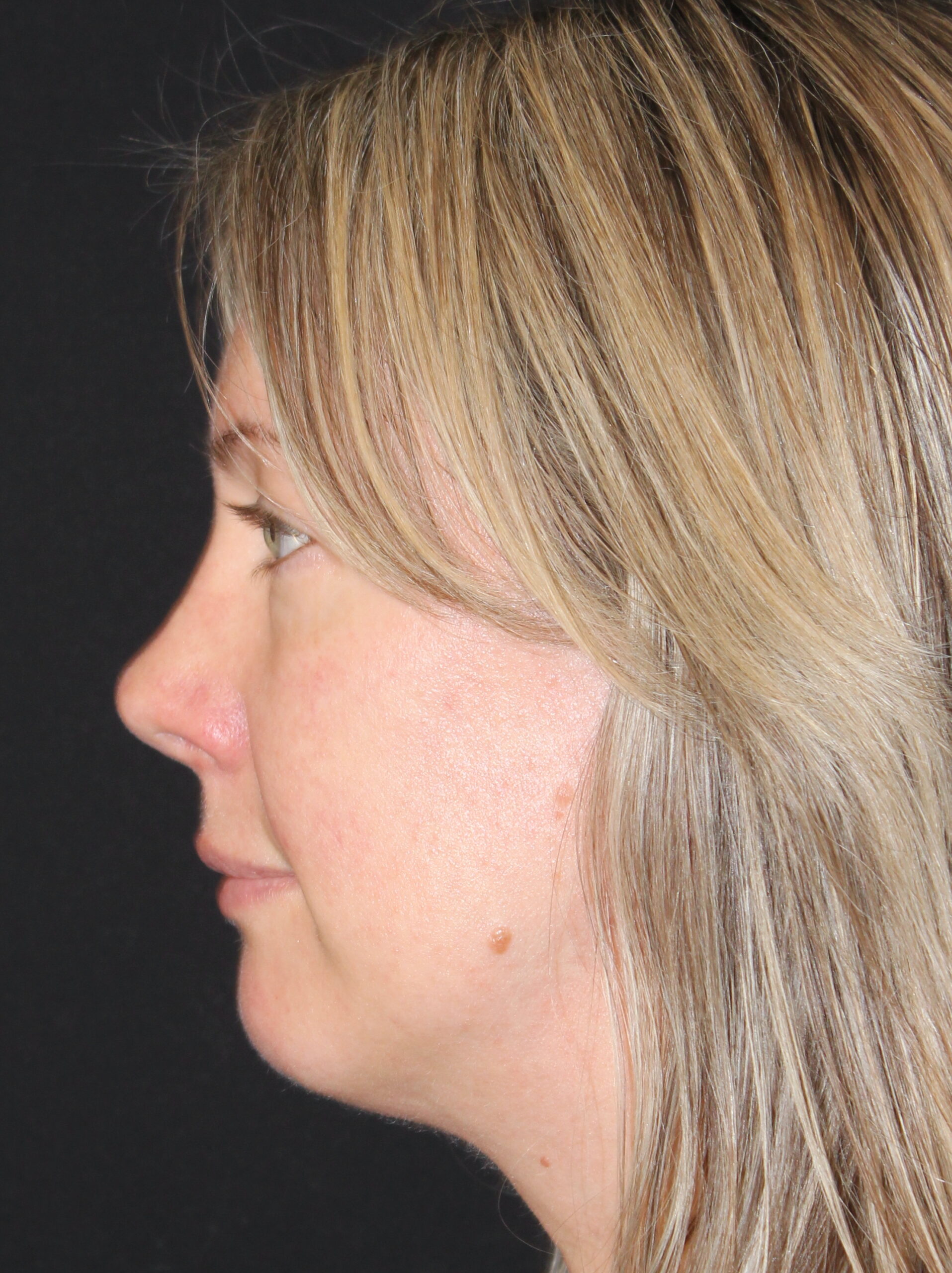 Patient 105 Before Image