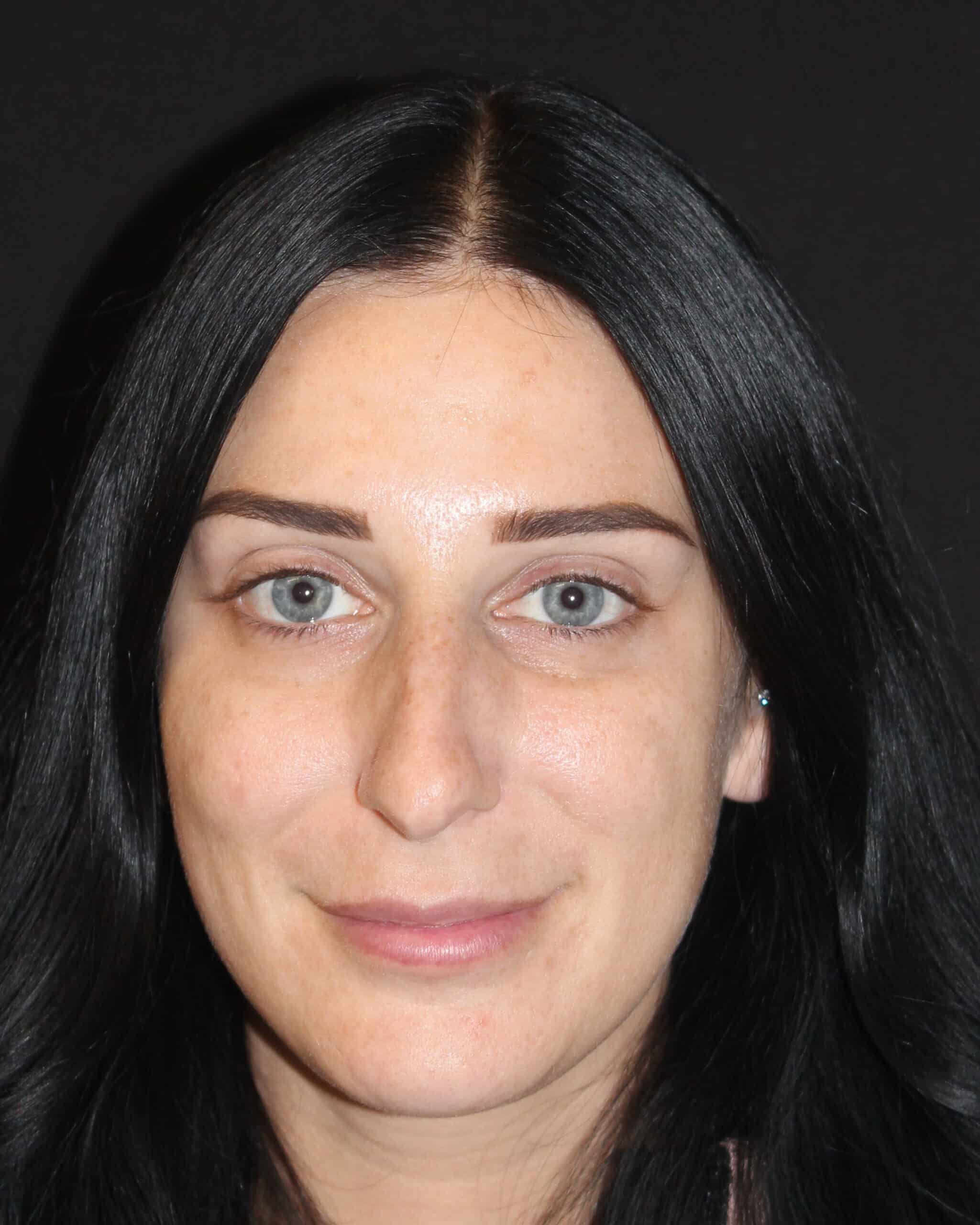 Patient 93 Before Image