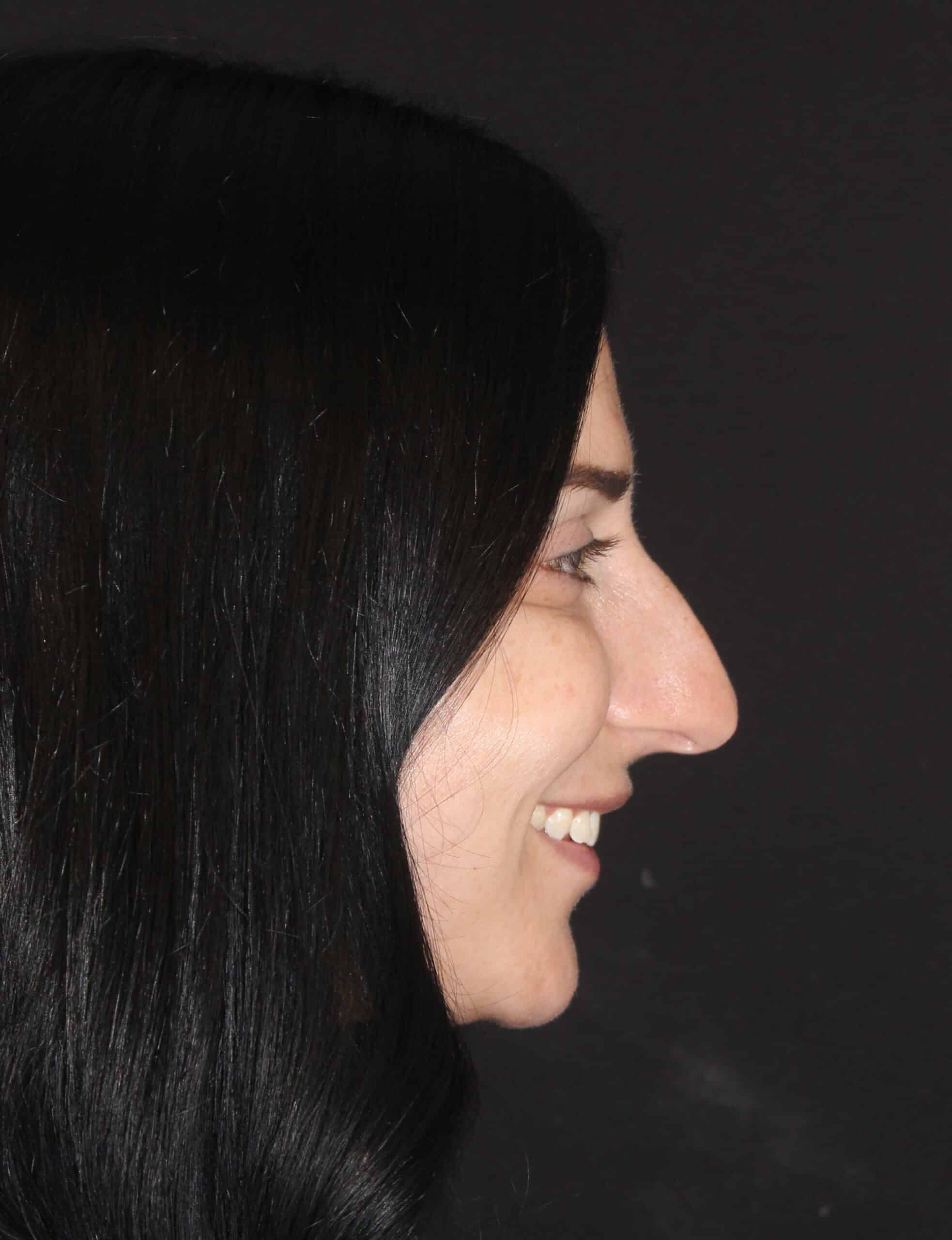 Patient 93 Before Image