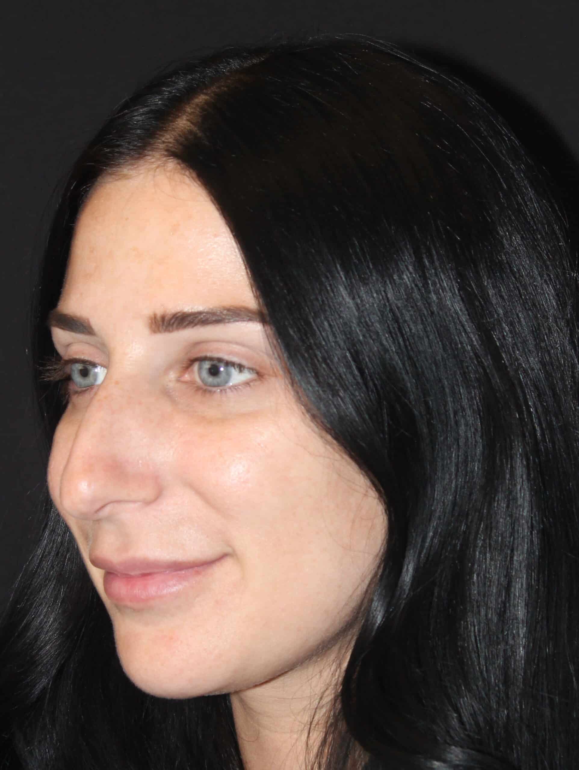 Patient 93 Before Image