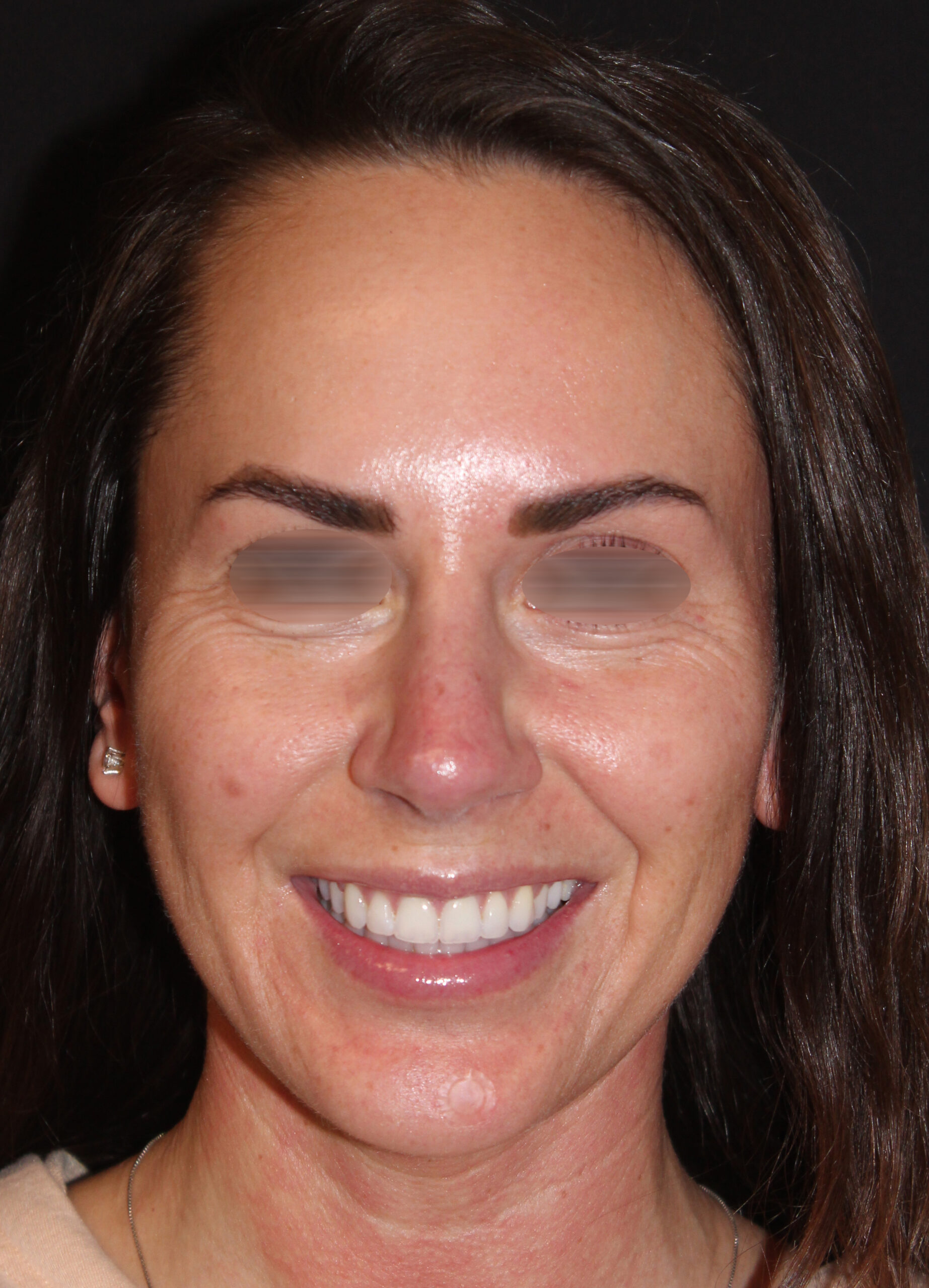 Patient 101 After Image