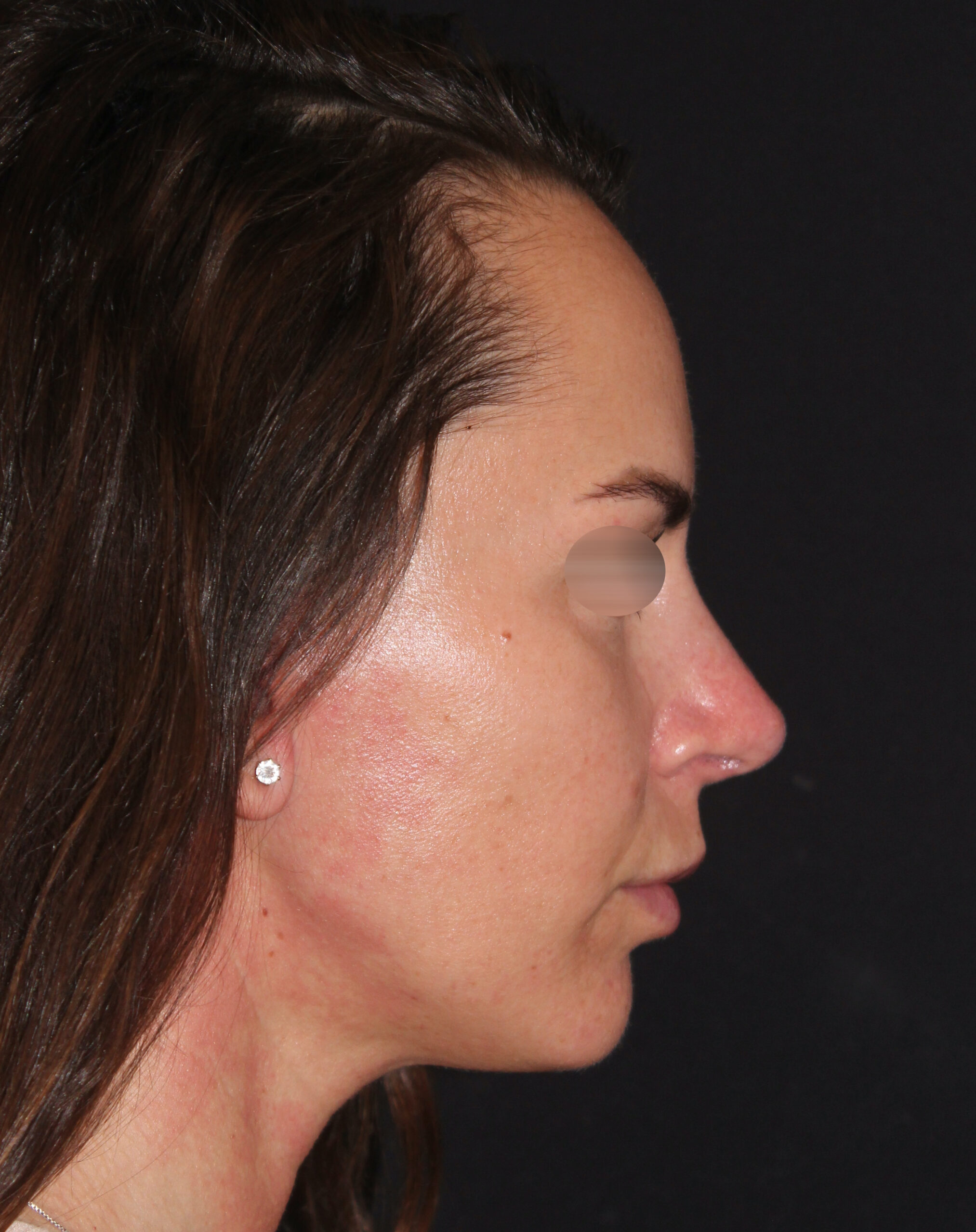 Patient 101 After Image