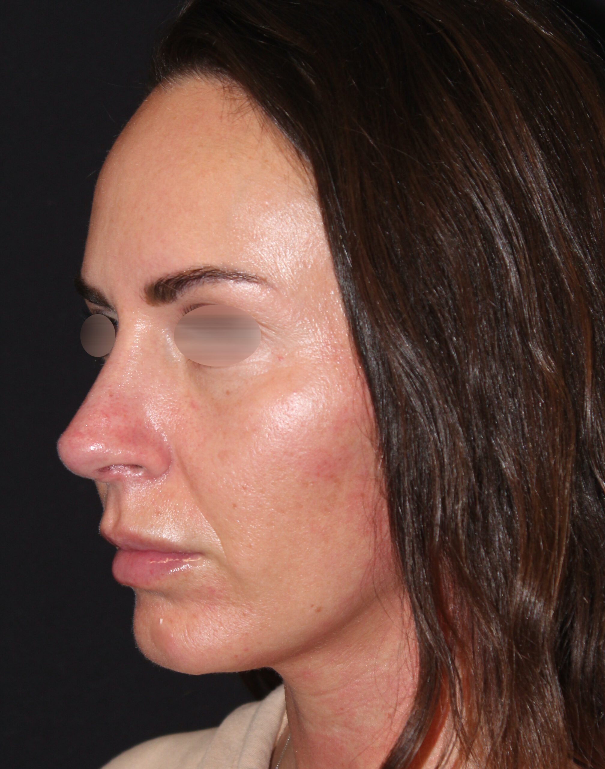 Patient 101 After Image