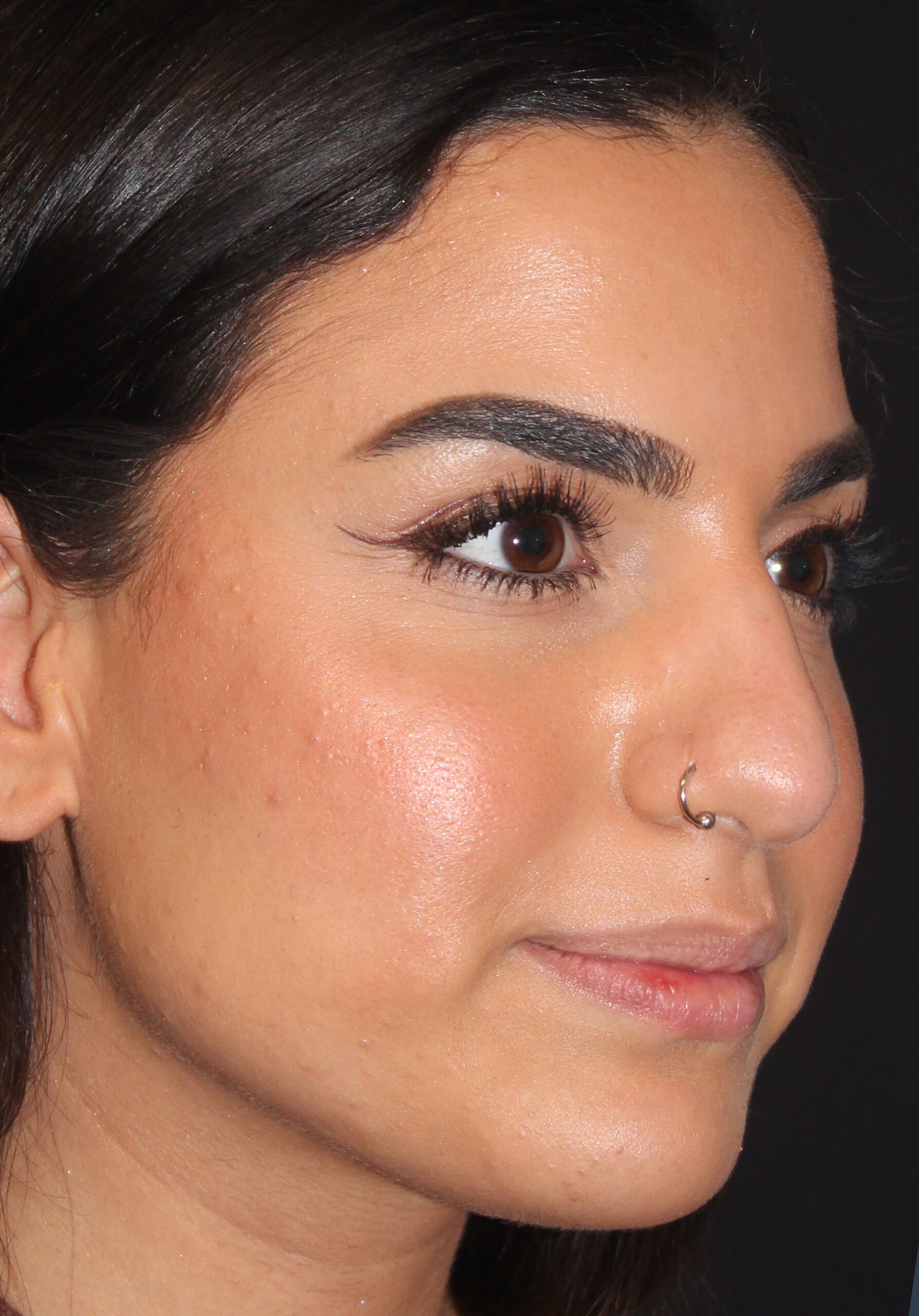 Patient #128 Before Image