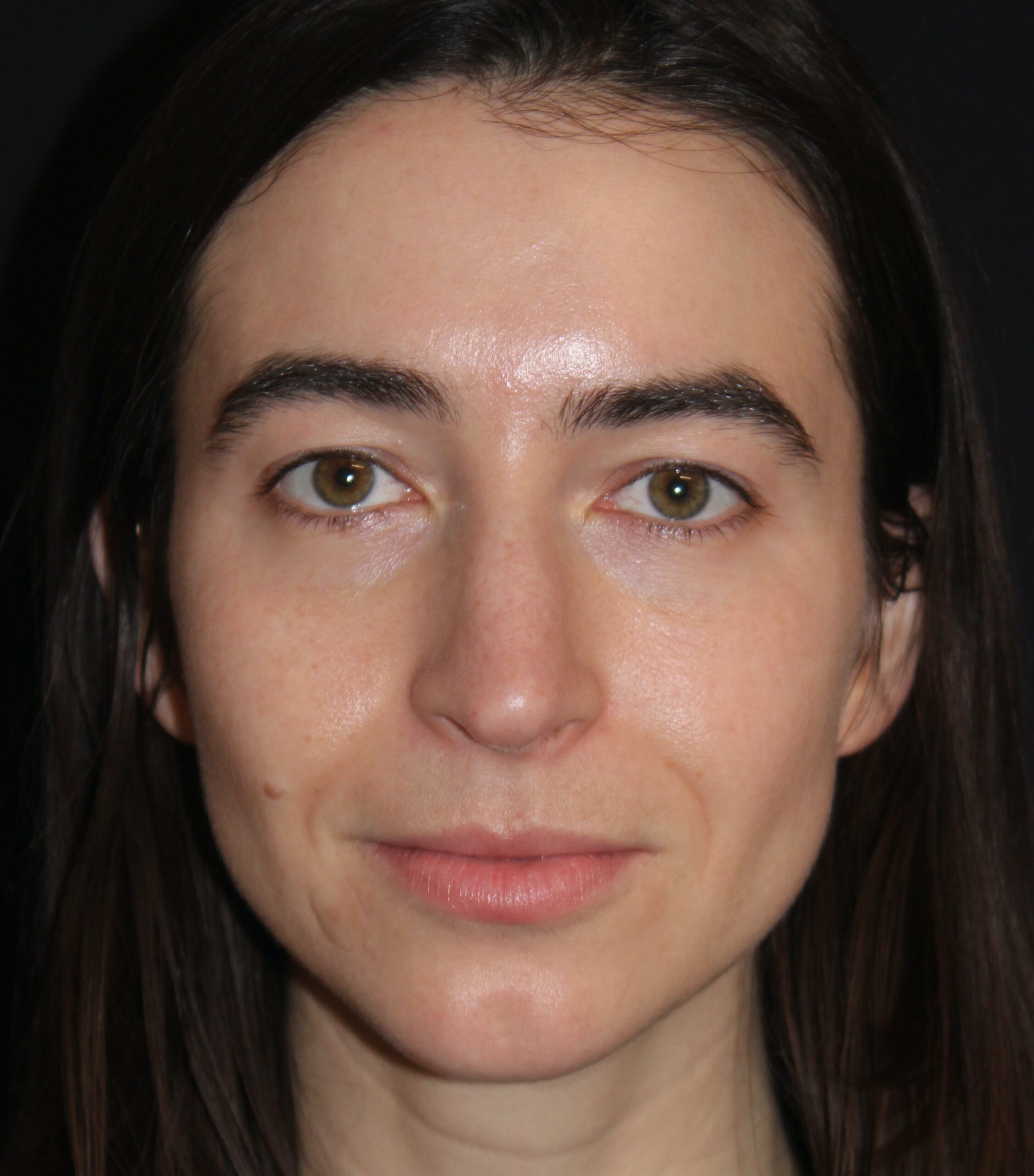 Patient #180 Before Image