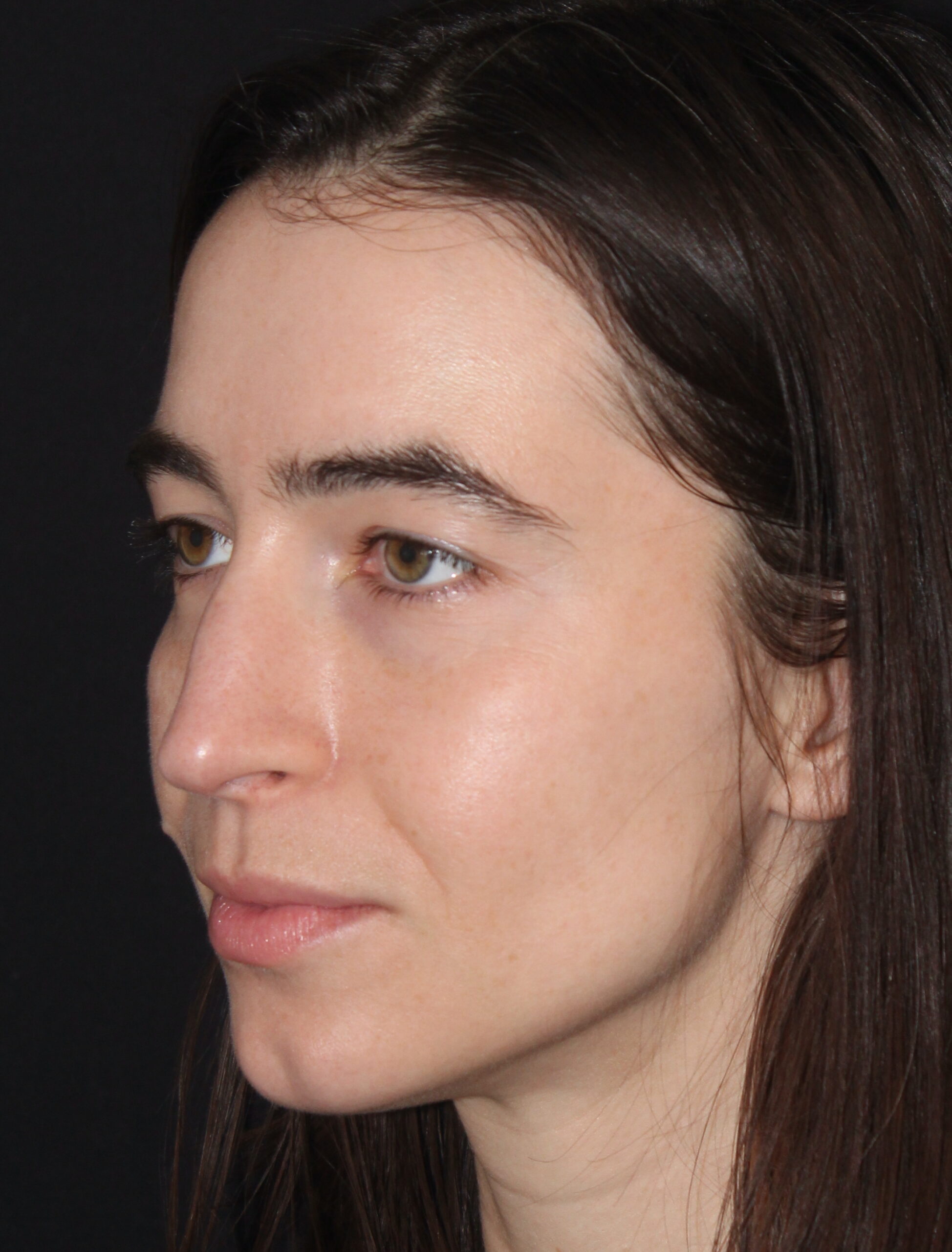 Patient #180 Before Image