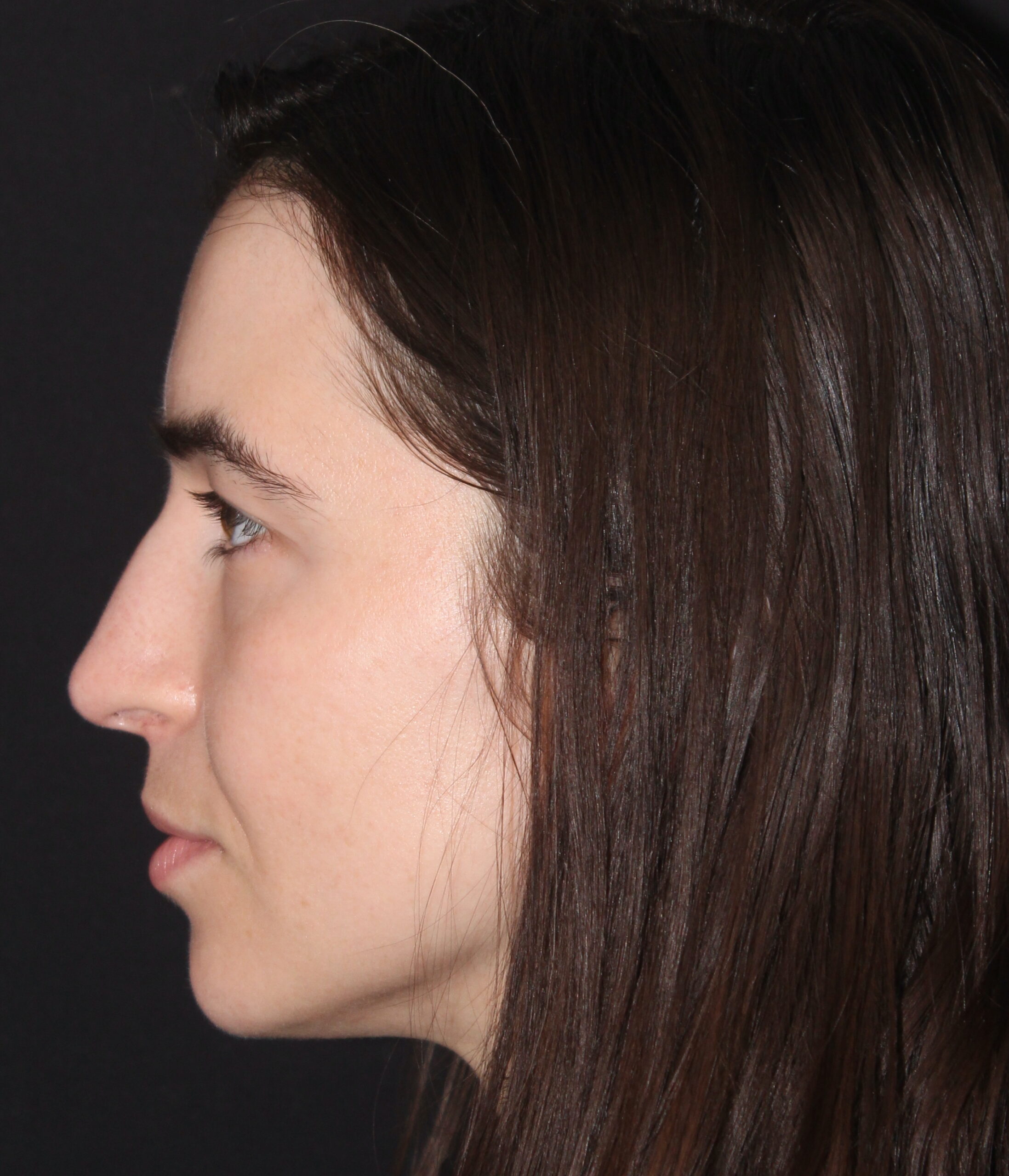 Patient #180 Before Image