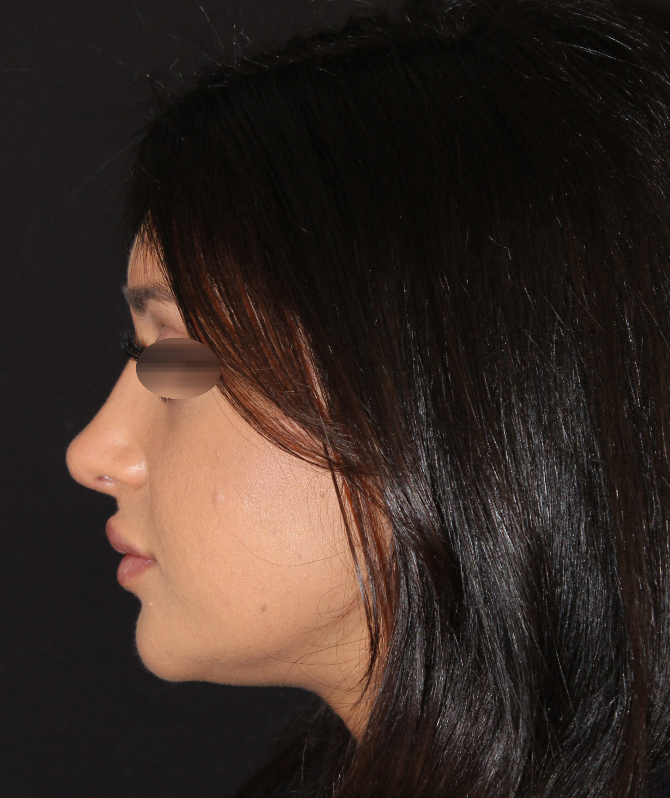 Patient #131 After Image