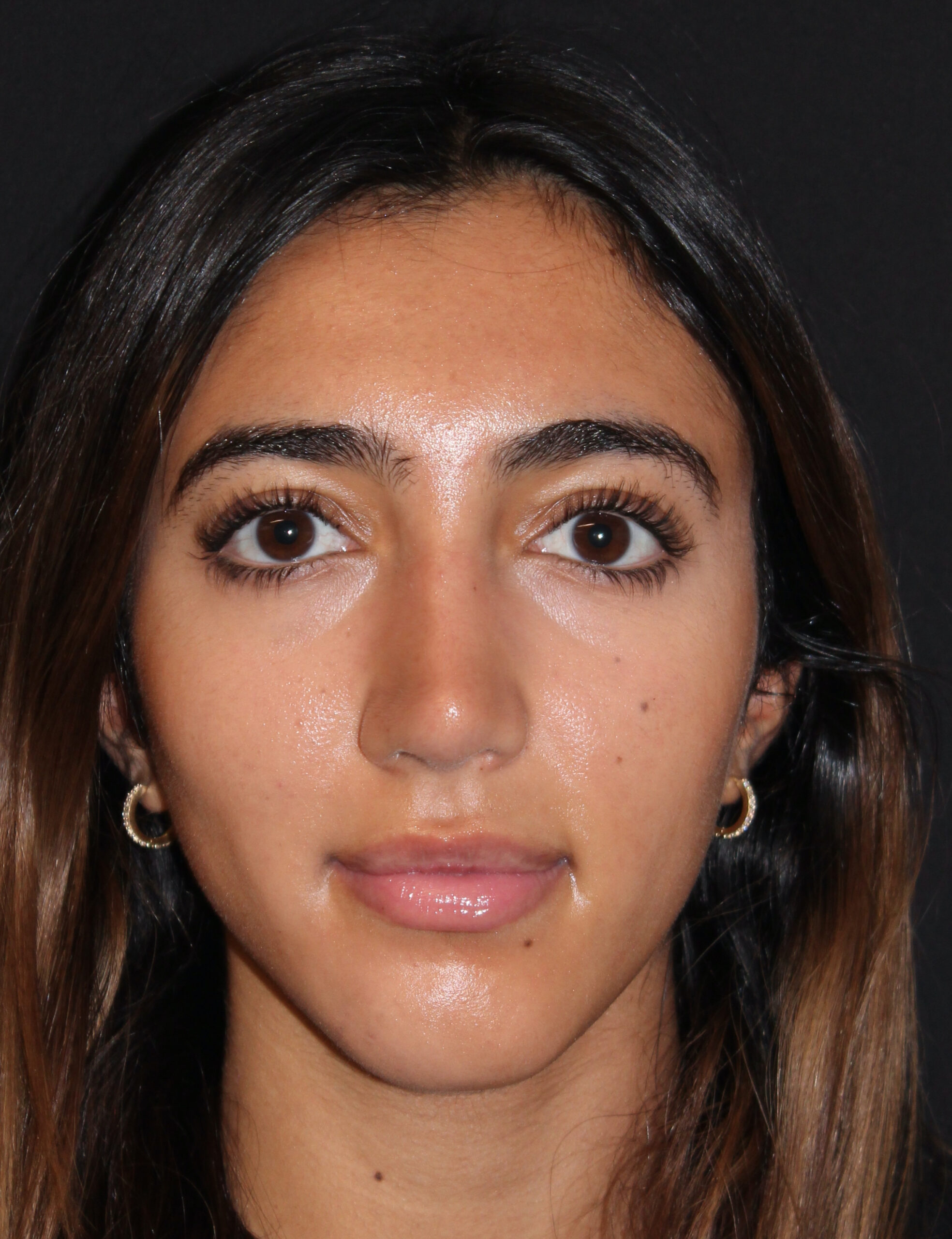 Patient #118 After Image