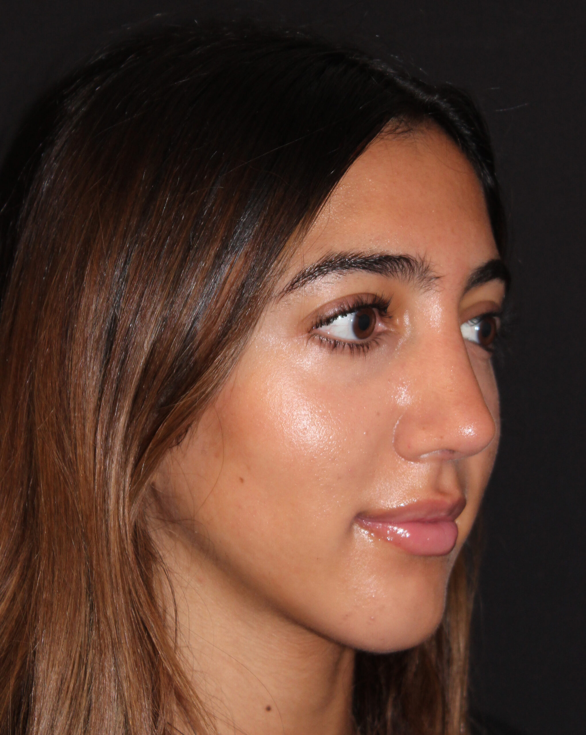 Patient #118 After Image