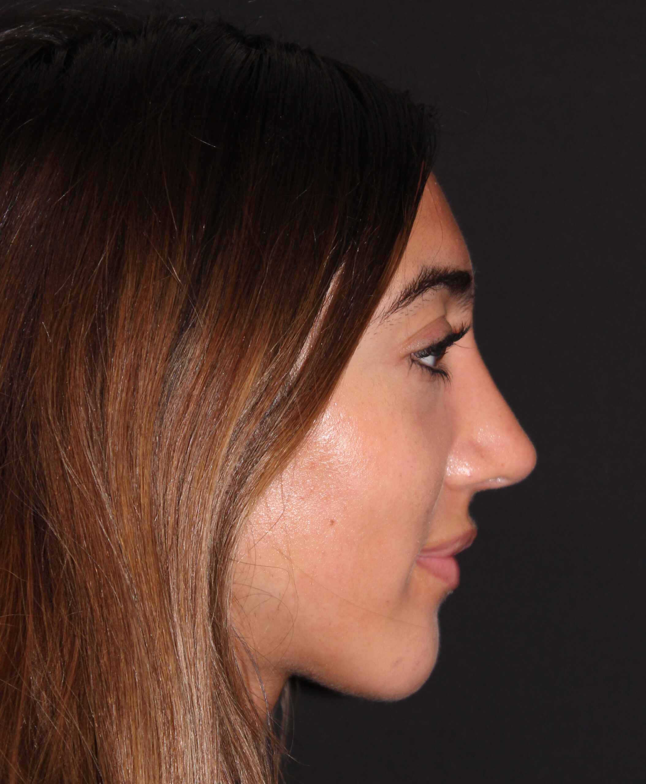 Patient #118 After Image