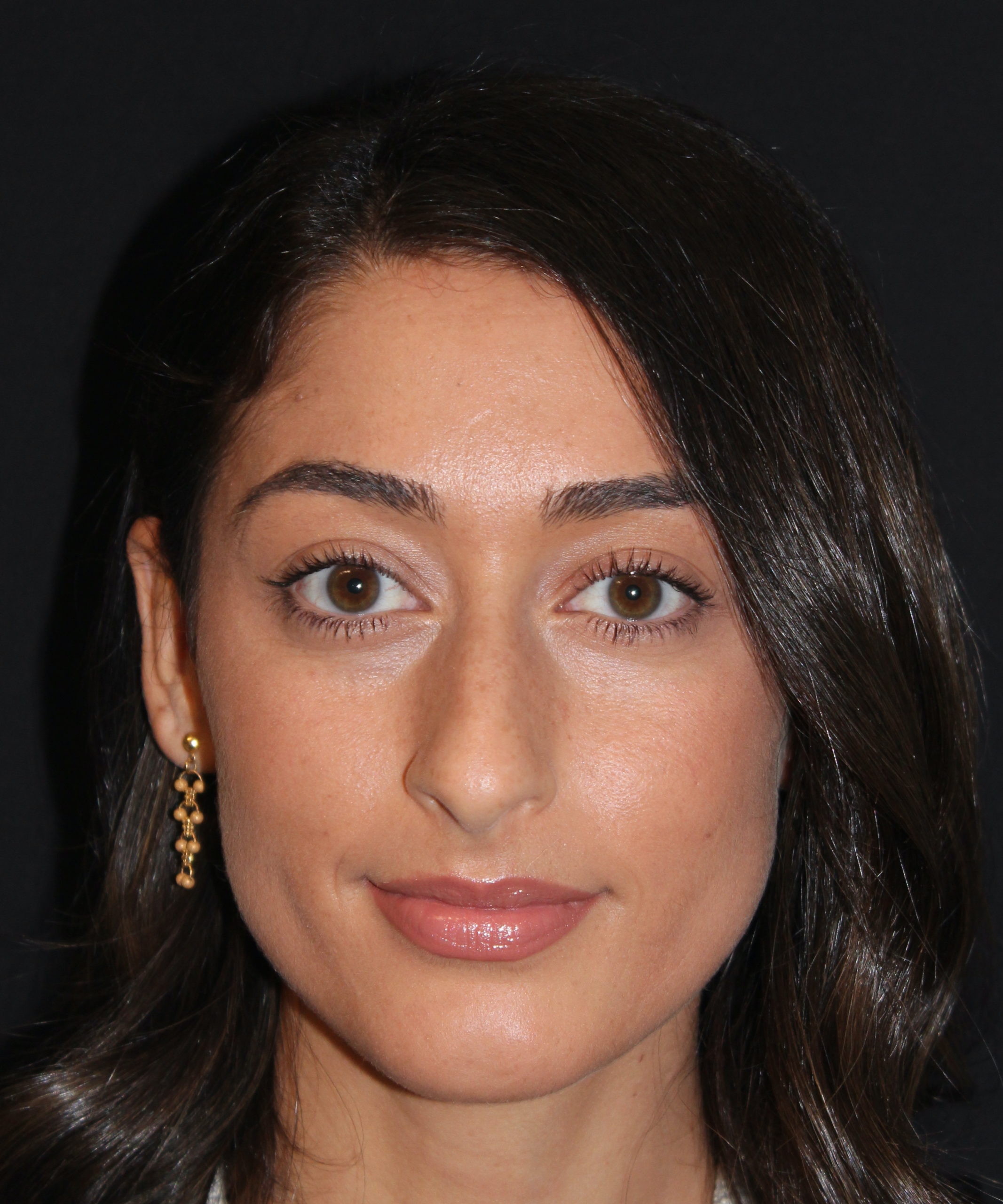 Patient 84 Before Image