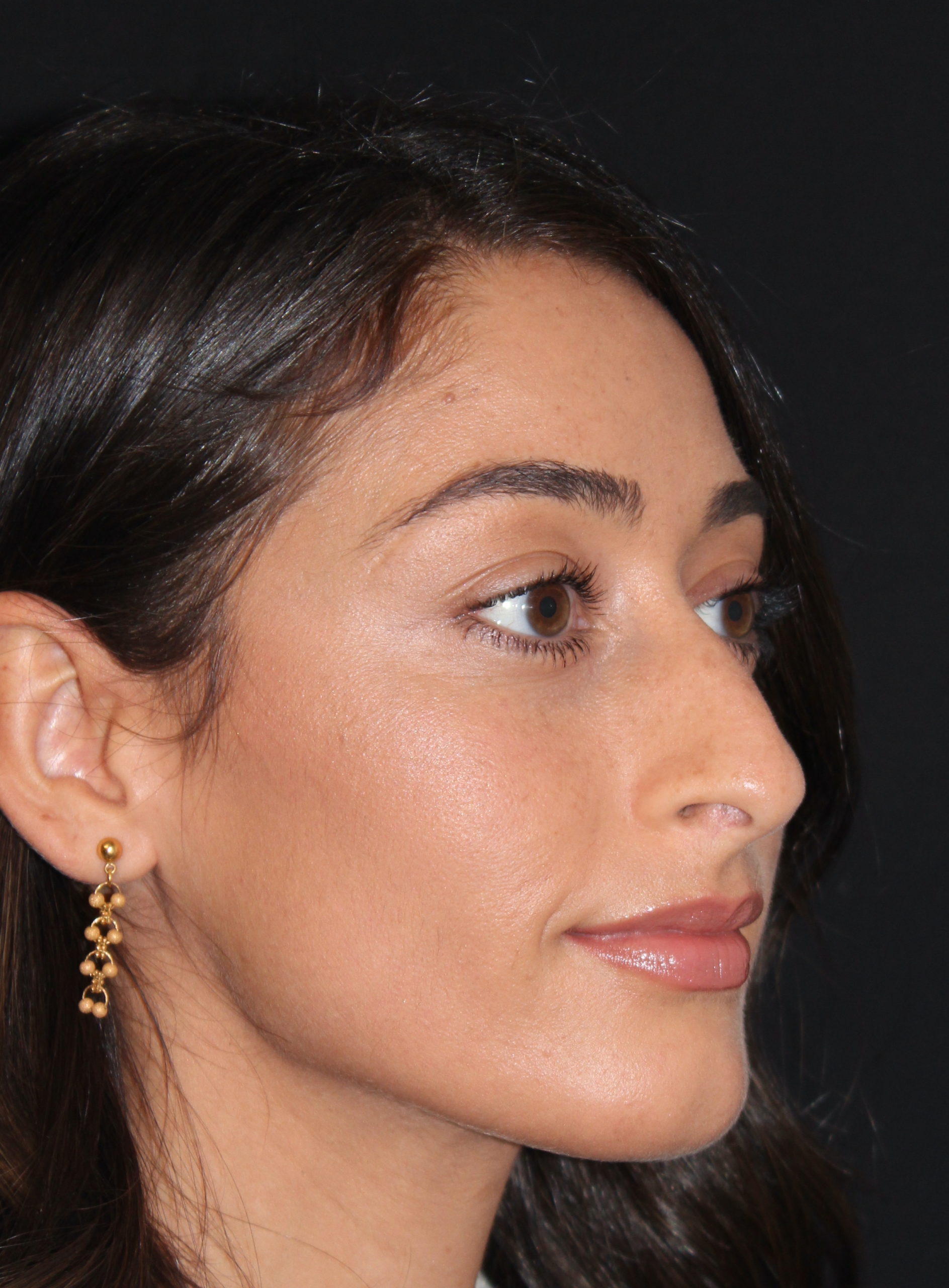 Patient 84 Before Image