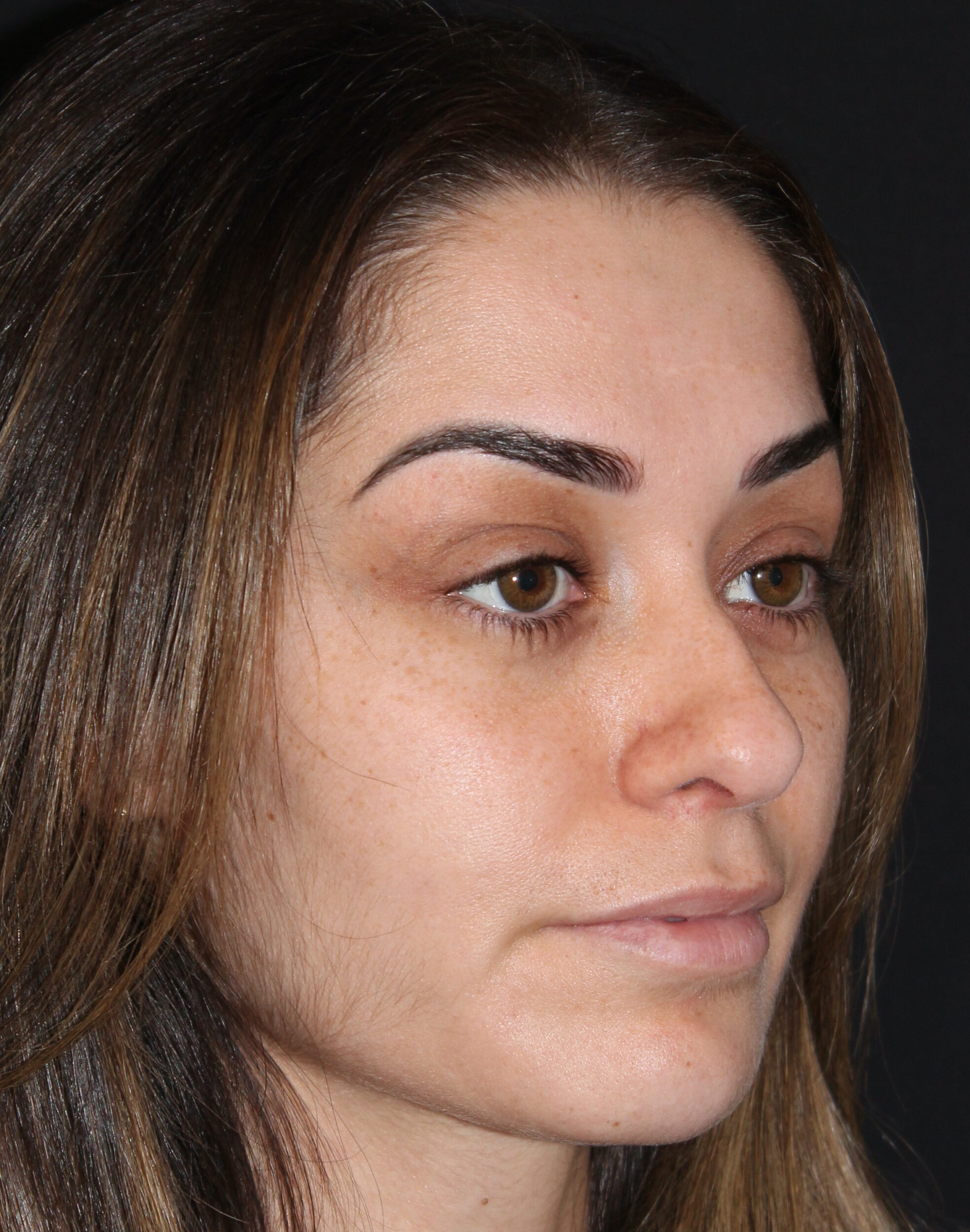 Patient #179 Before Image