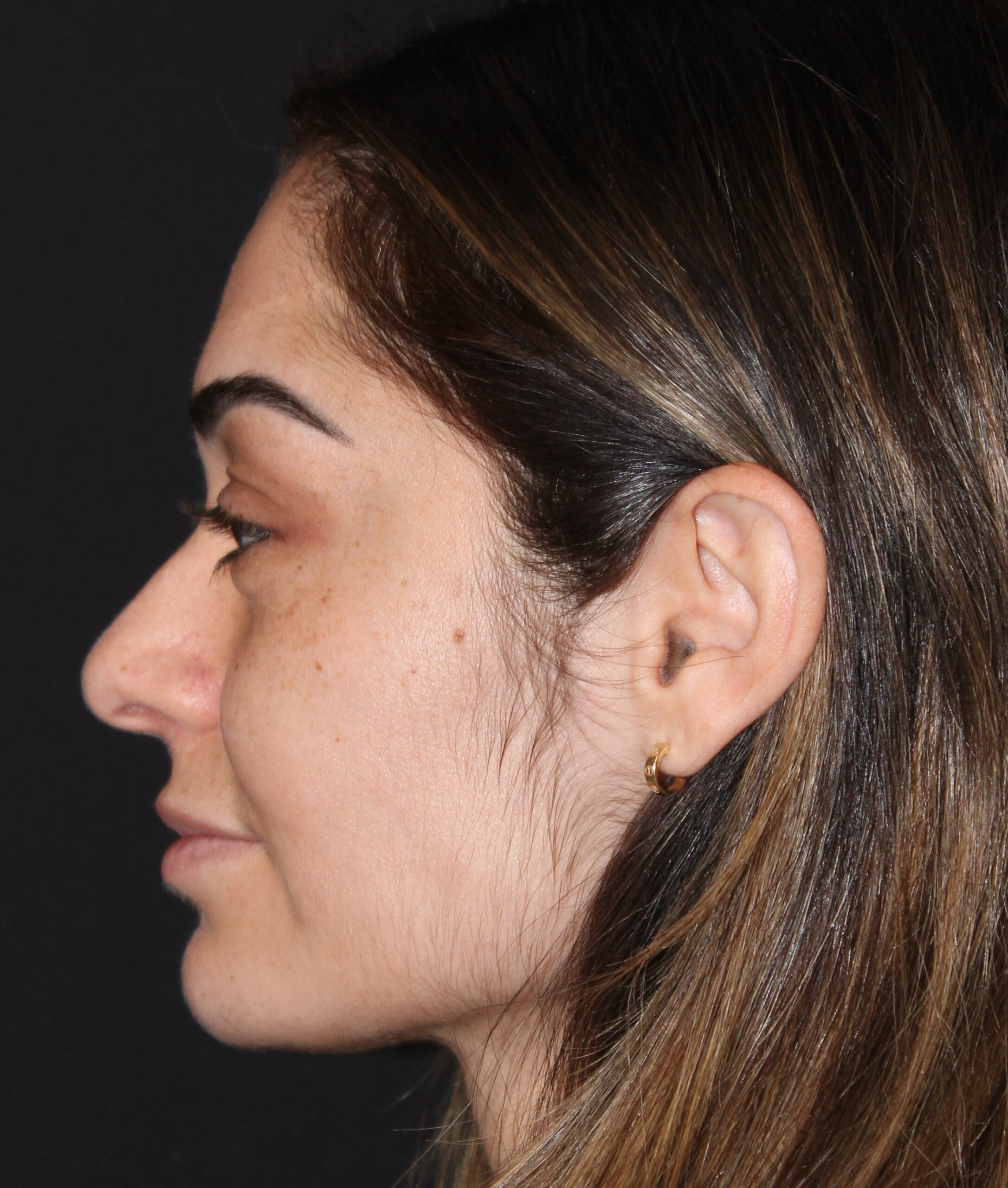 Patient #179 Before Image