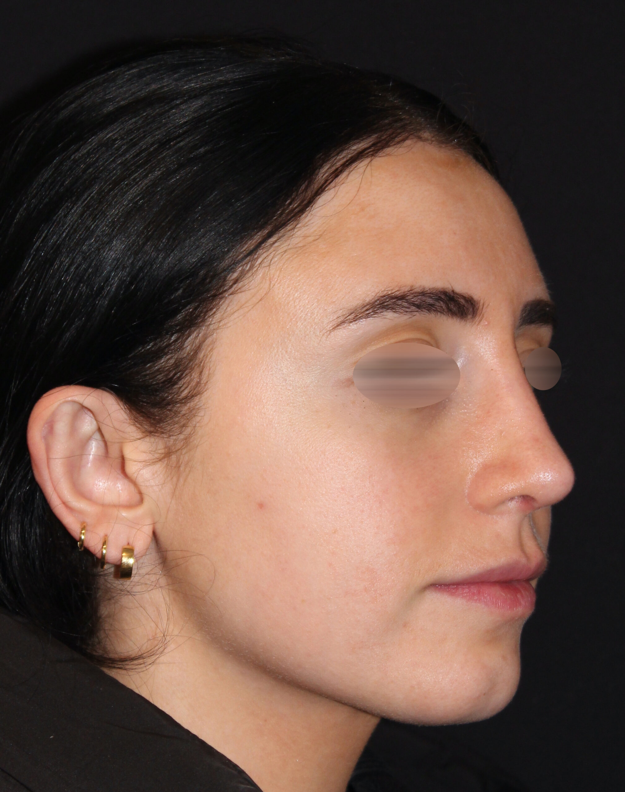 Patient #116 After Image