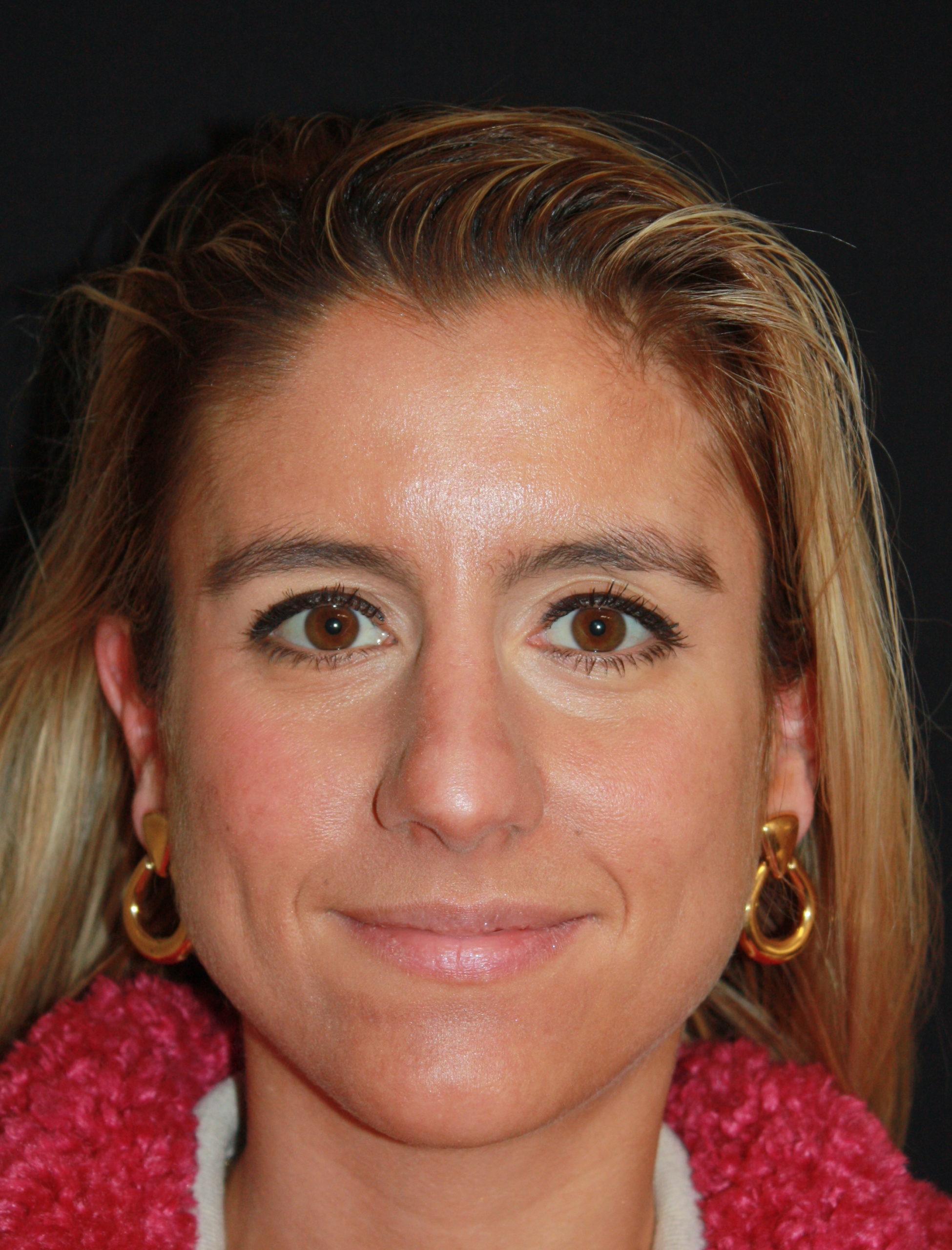 Patient 59 Before Image