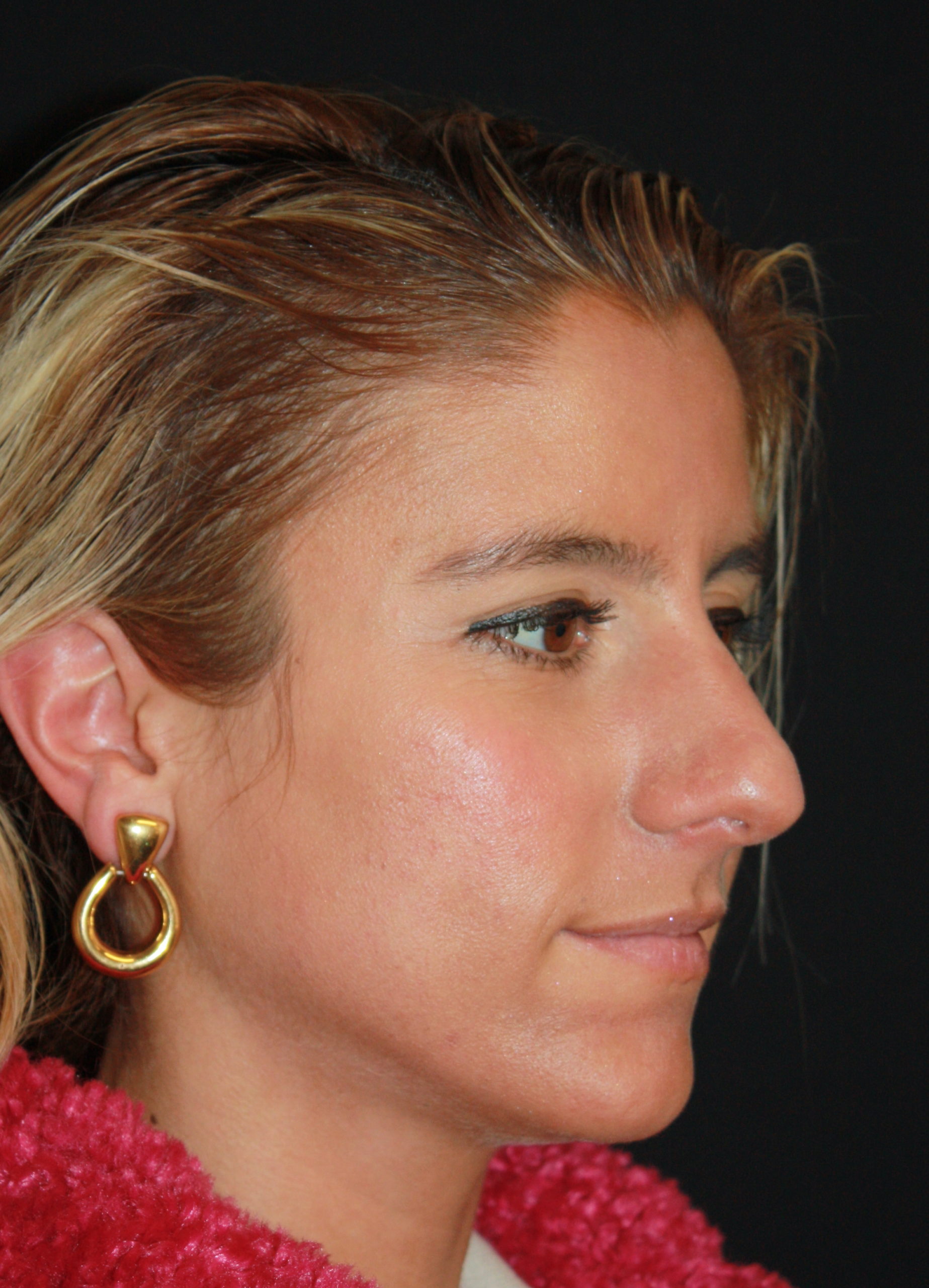 Patient 59 Before Image