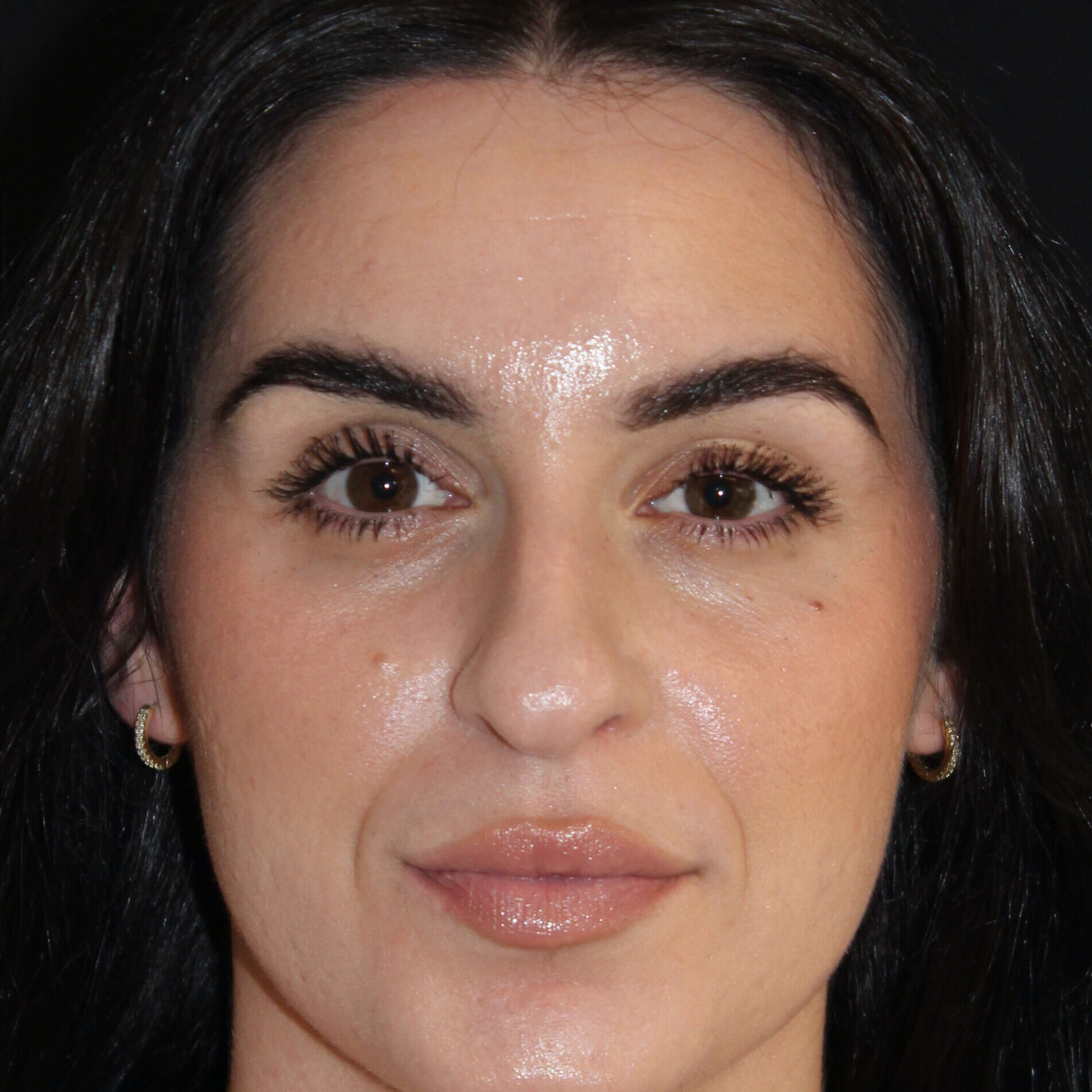 Patient #172 Before Image