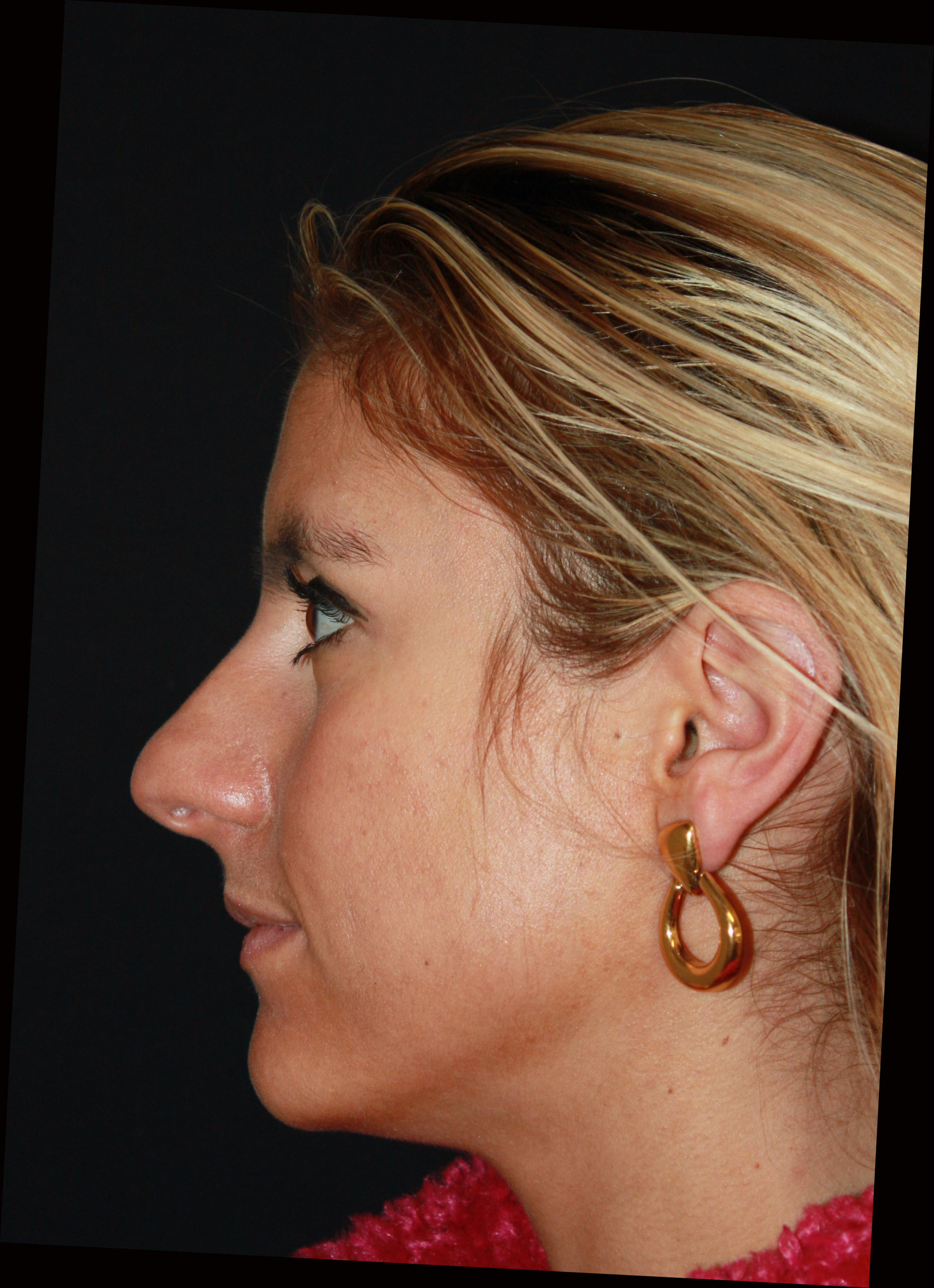 Patient 59 Before Image