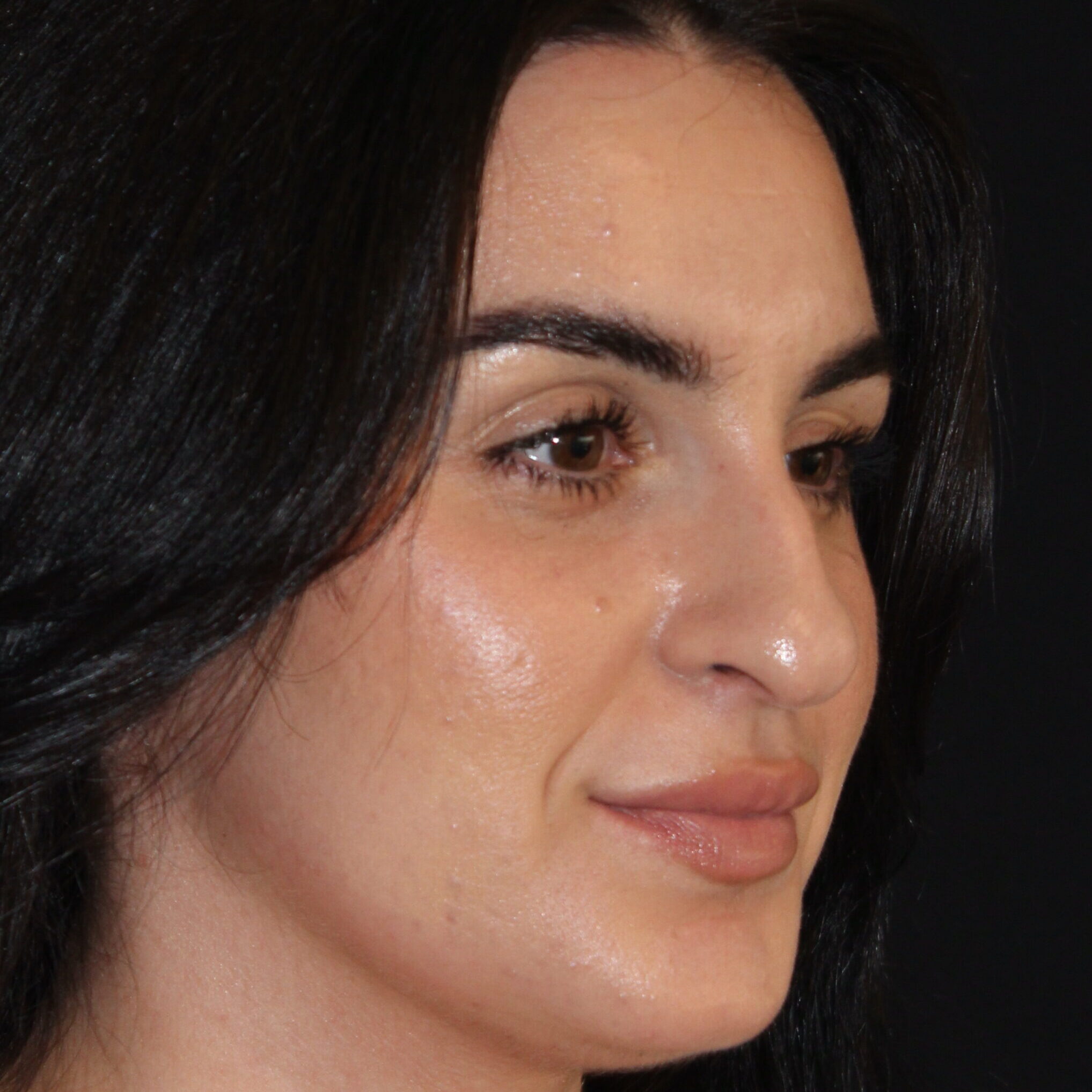 Patient #172 Before Image