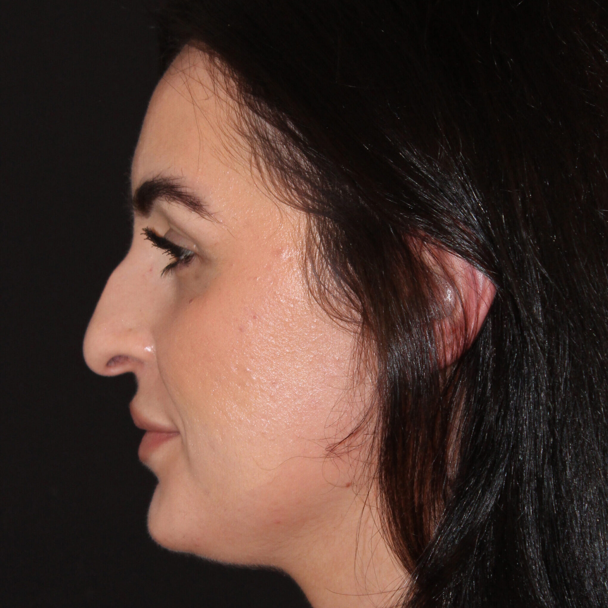 Patient #172 Before Image