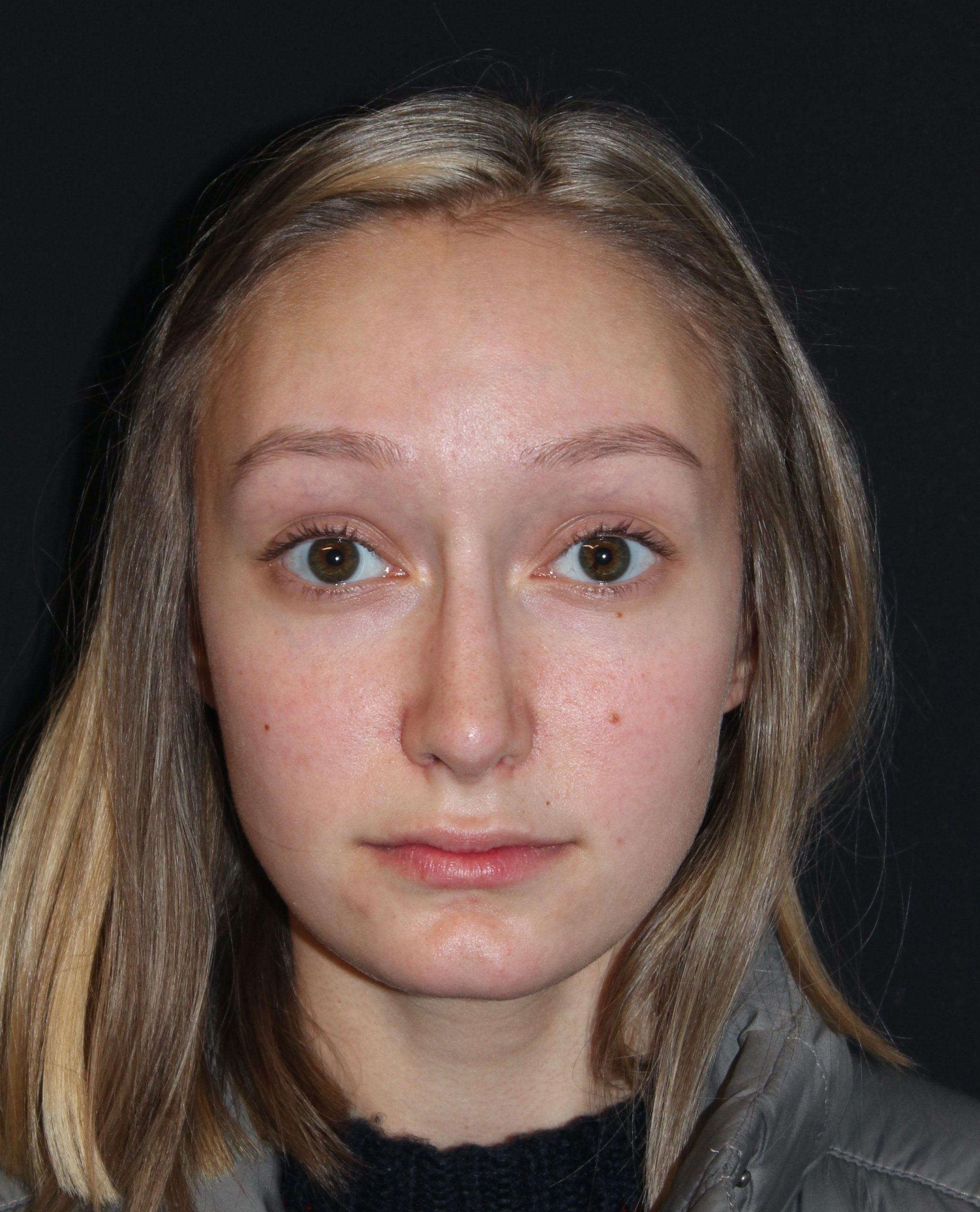 Patient 76 After Image