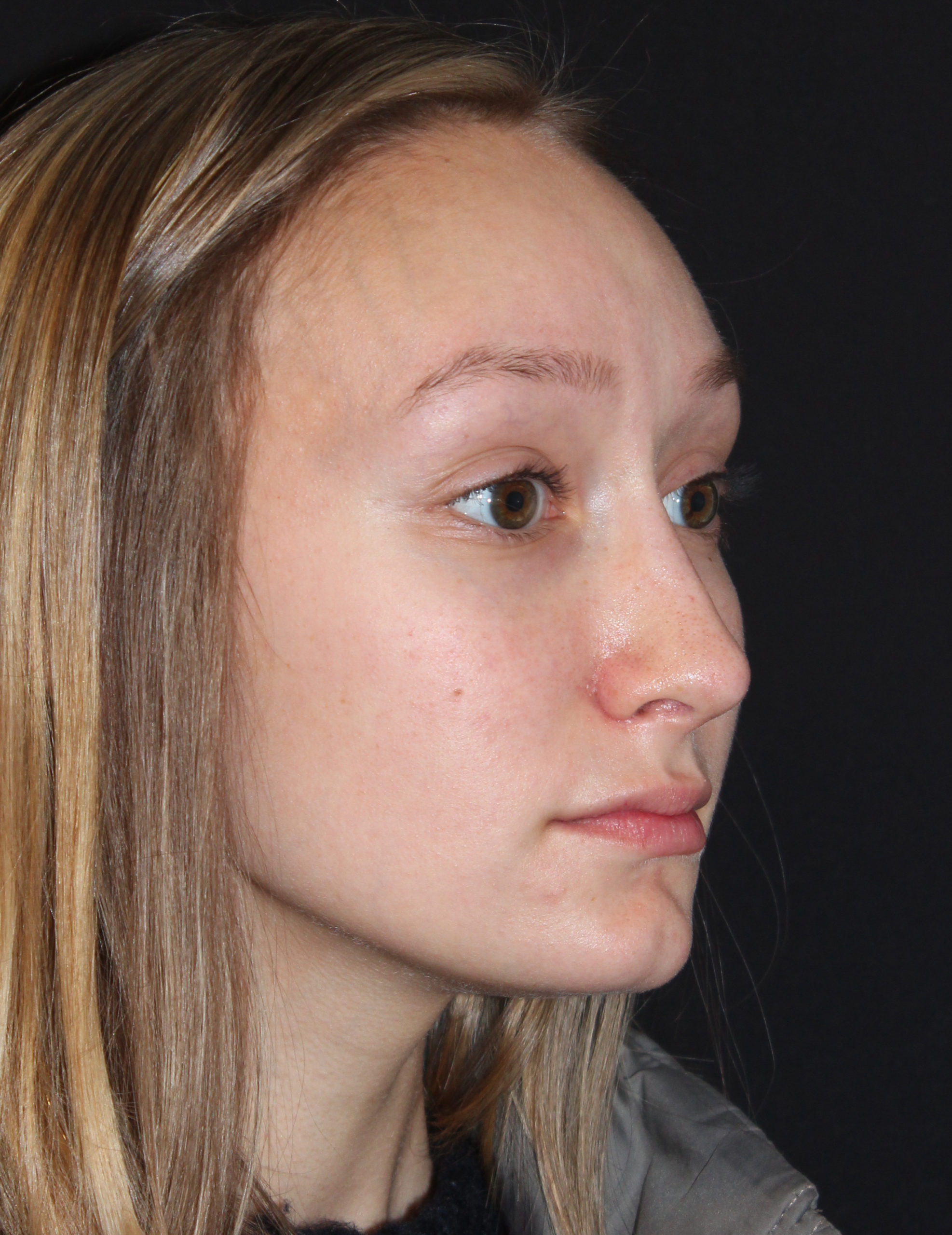 Patient 76 After Image