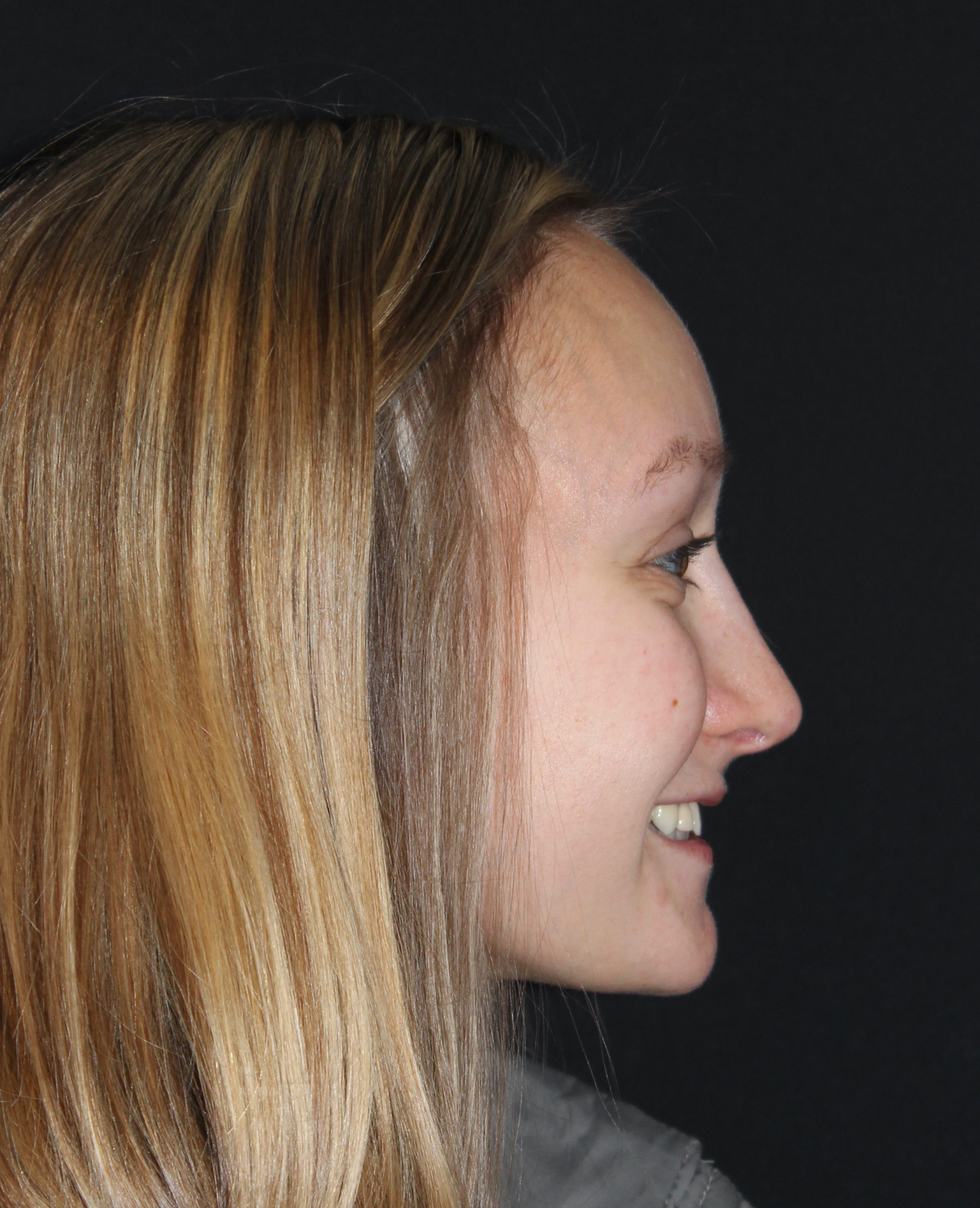 Patient 76 After Image