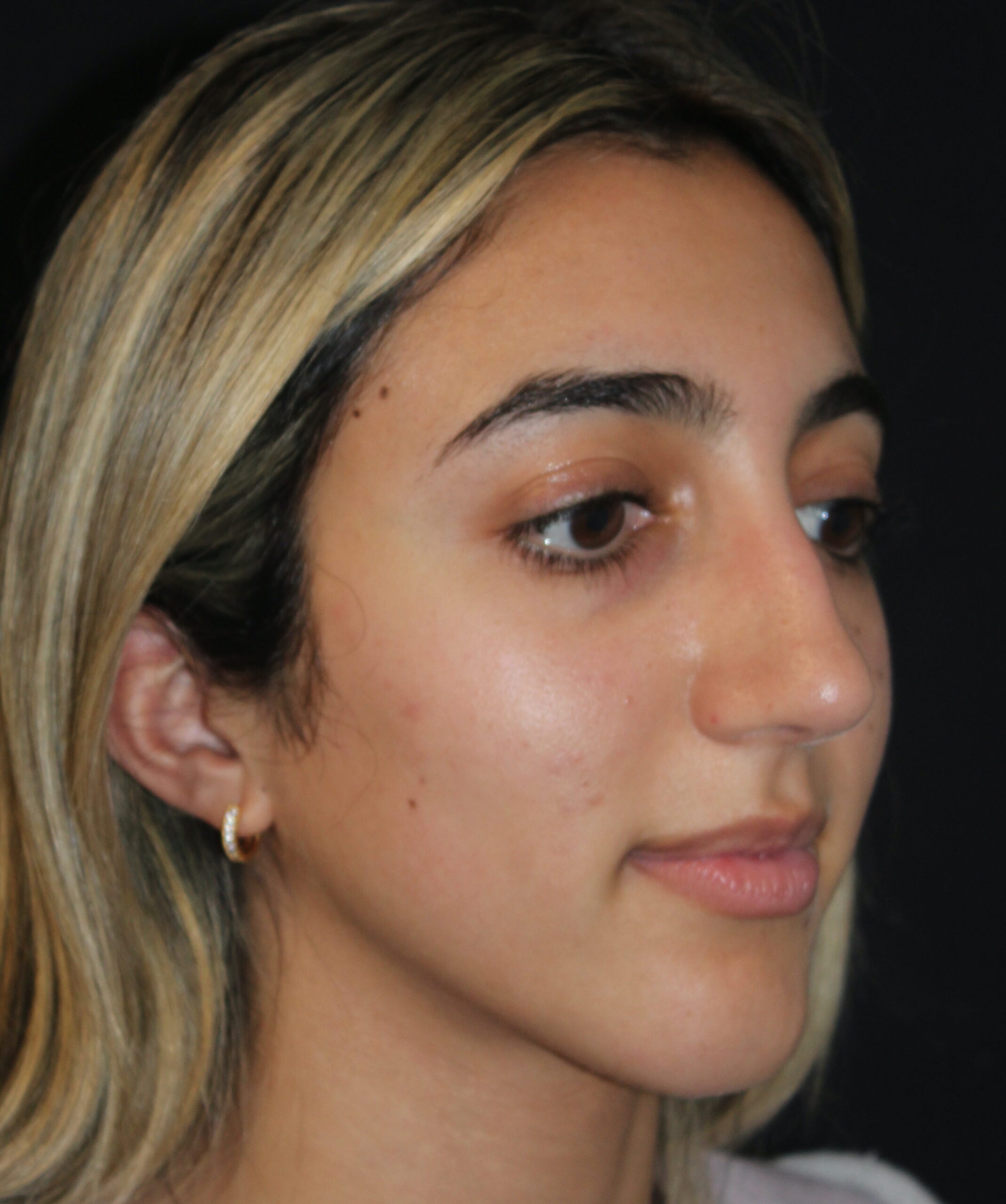 Patient #118 Before Image