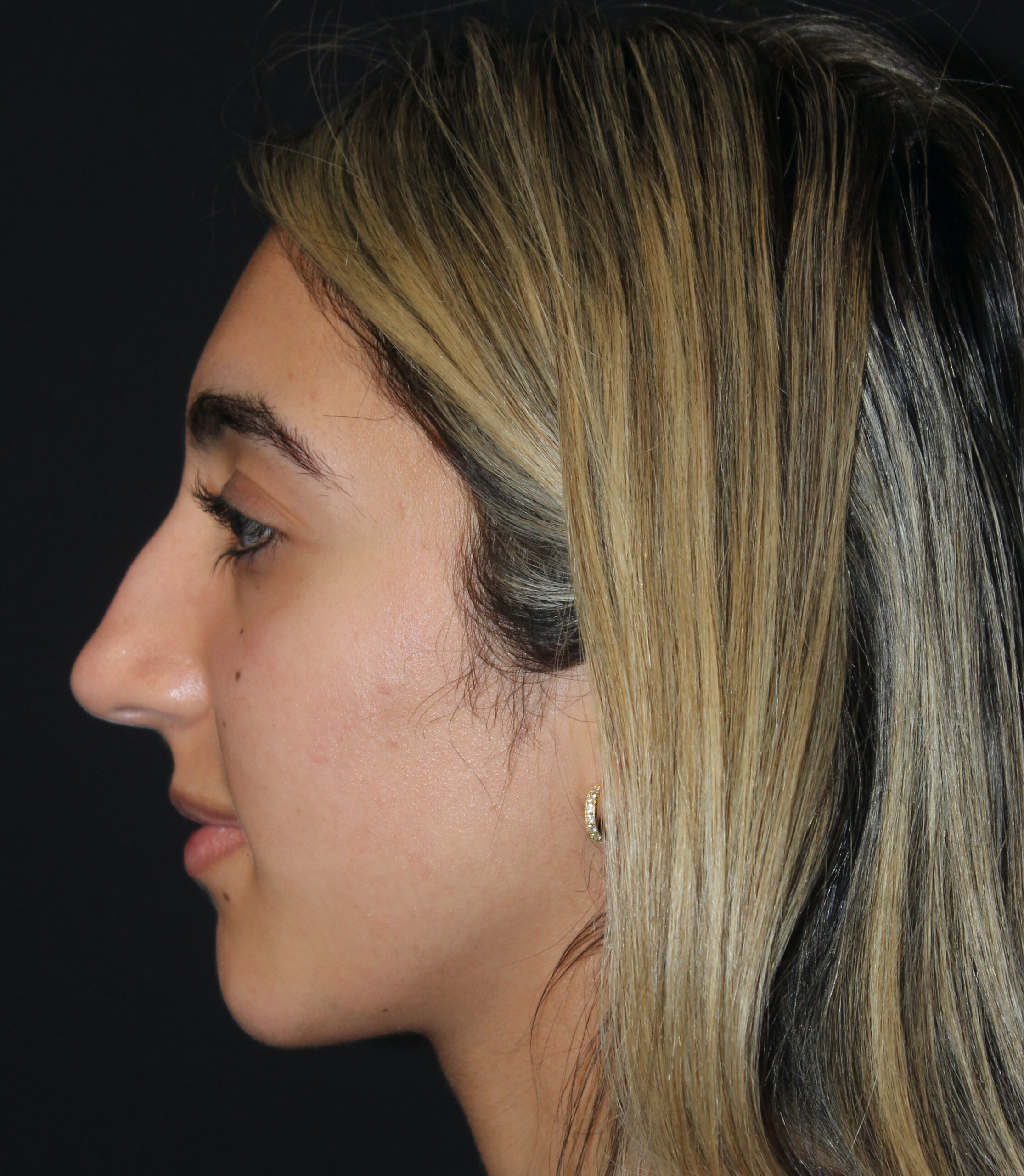 Patient #118 Before Image