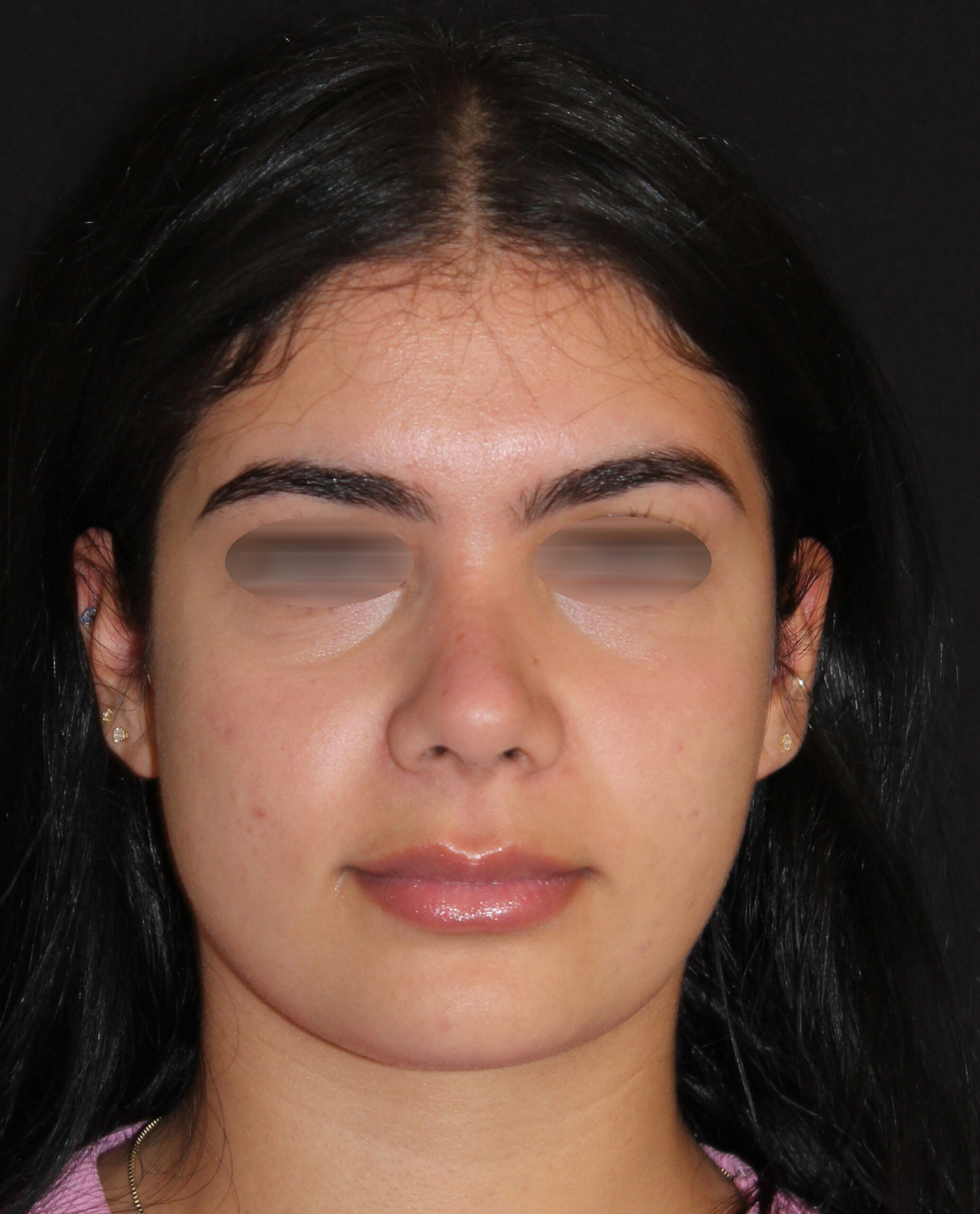 Patient #142 After Image