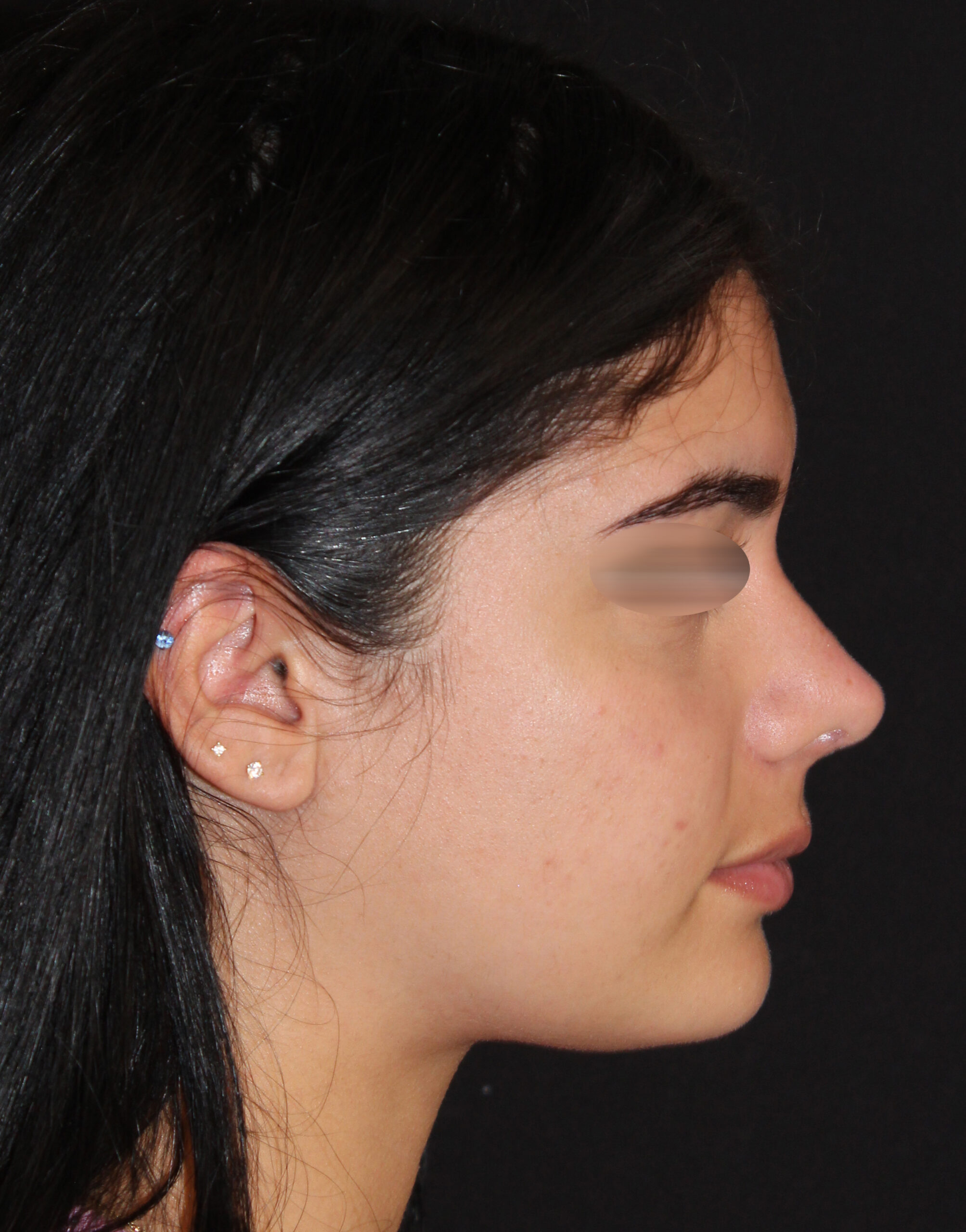 Patient #142 After Image