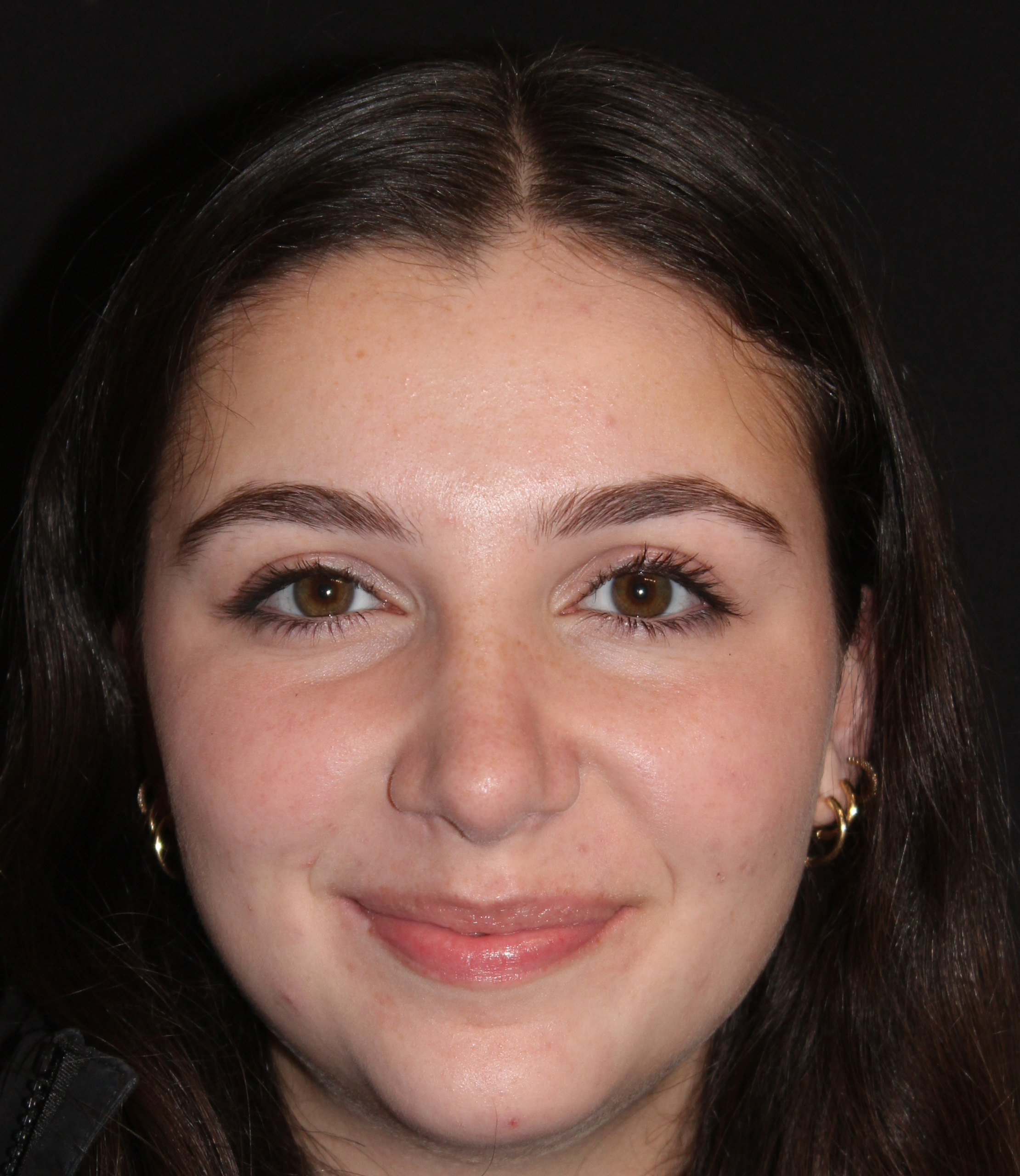 Patient #117 After Image