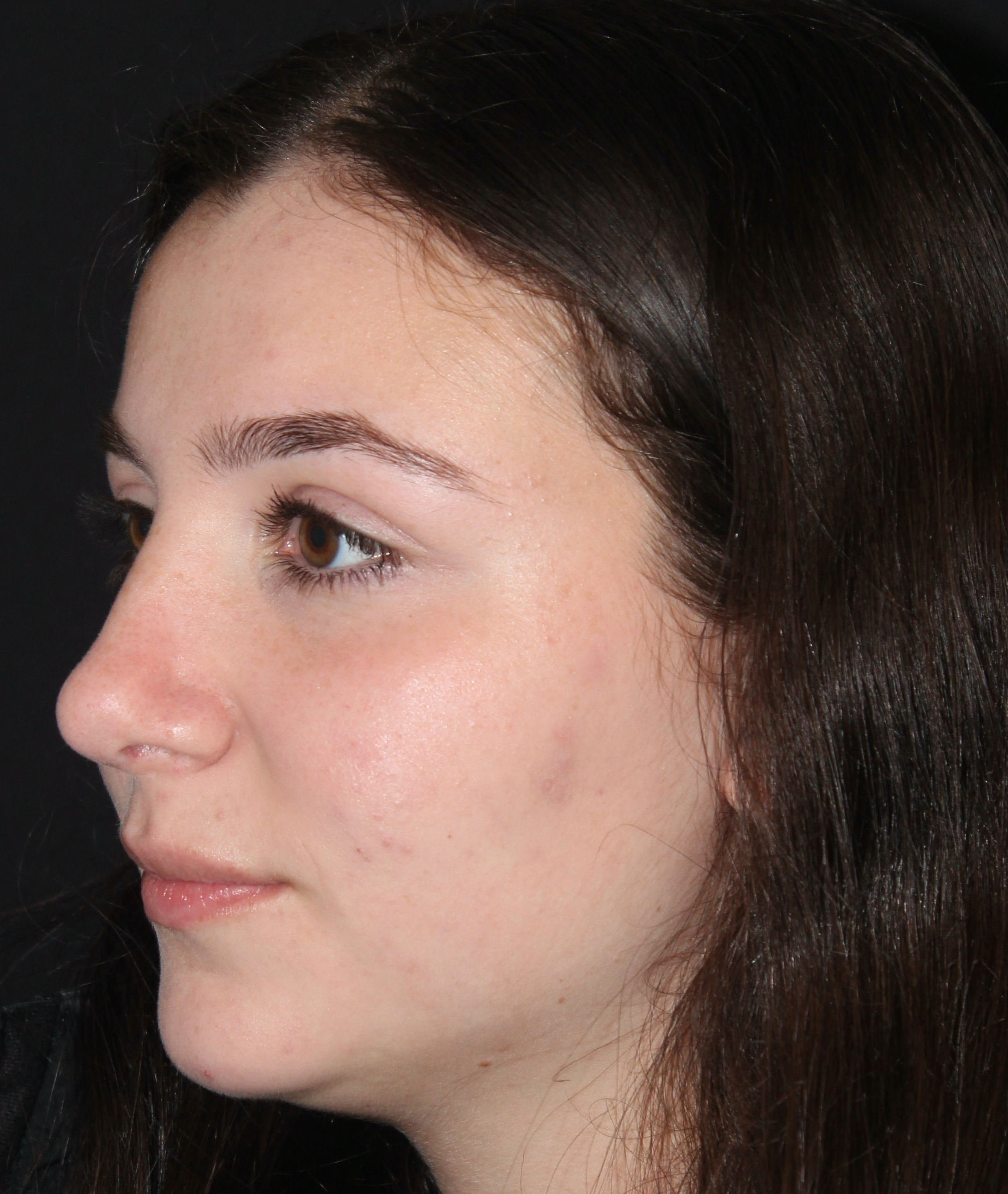 Patient #117 After Image