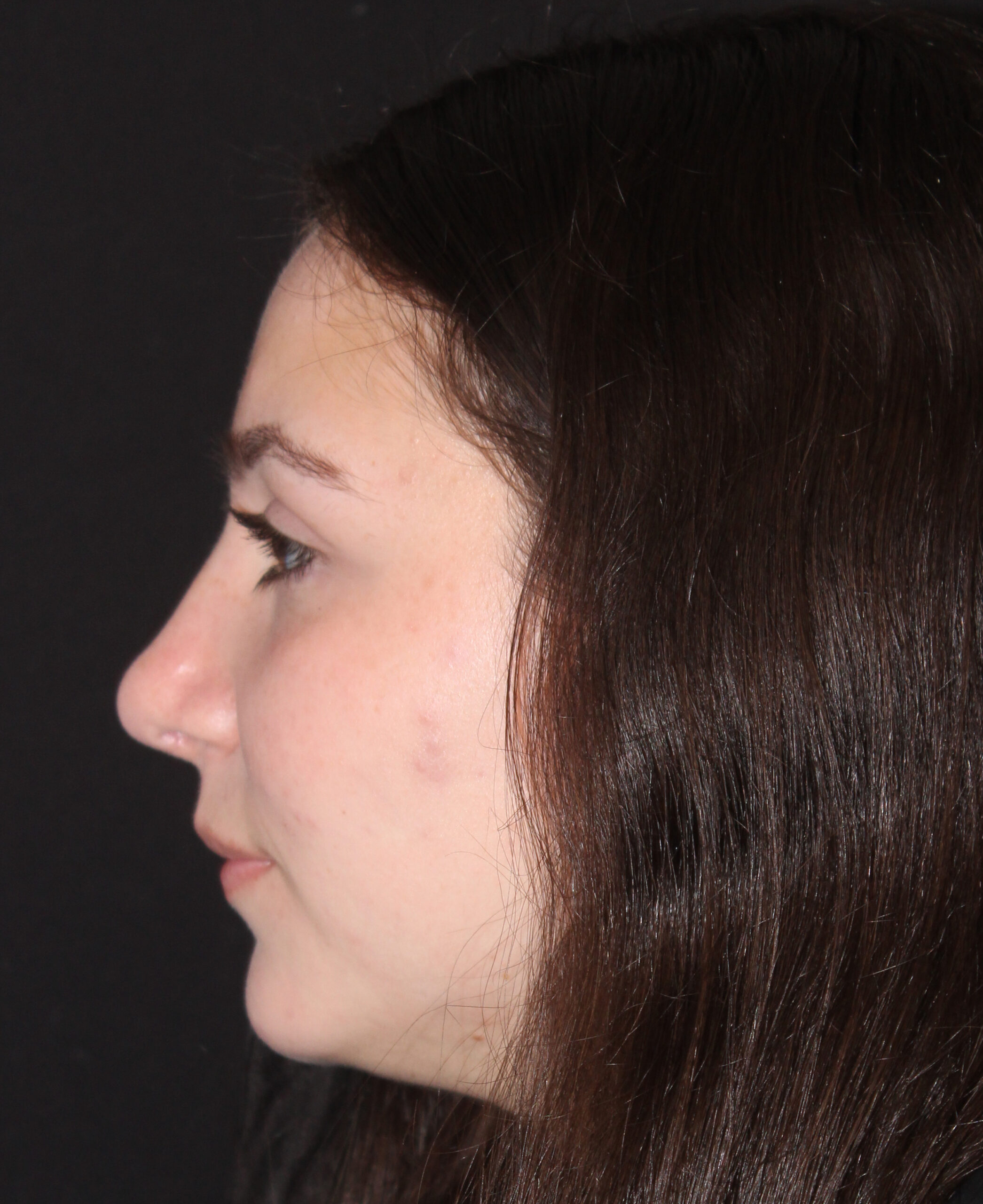 Patient #117 After Image