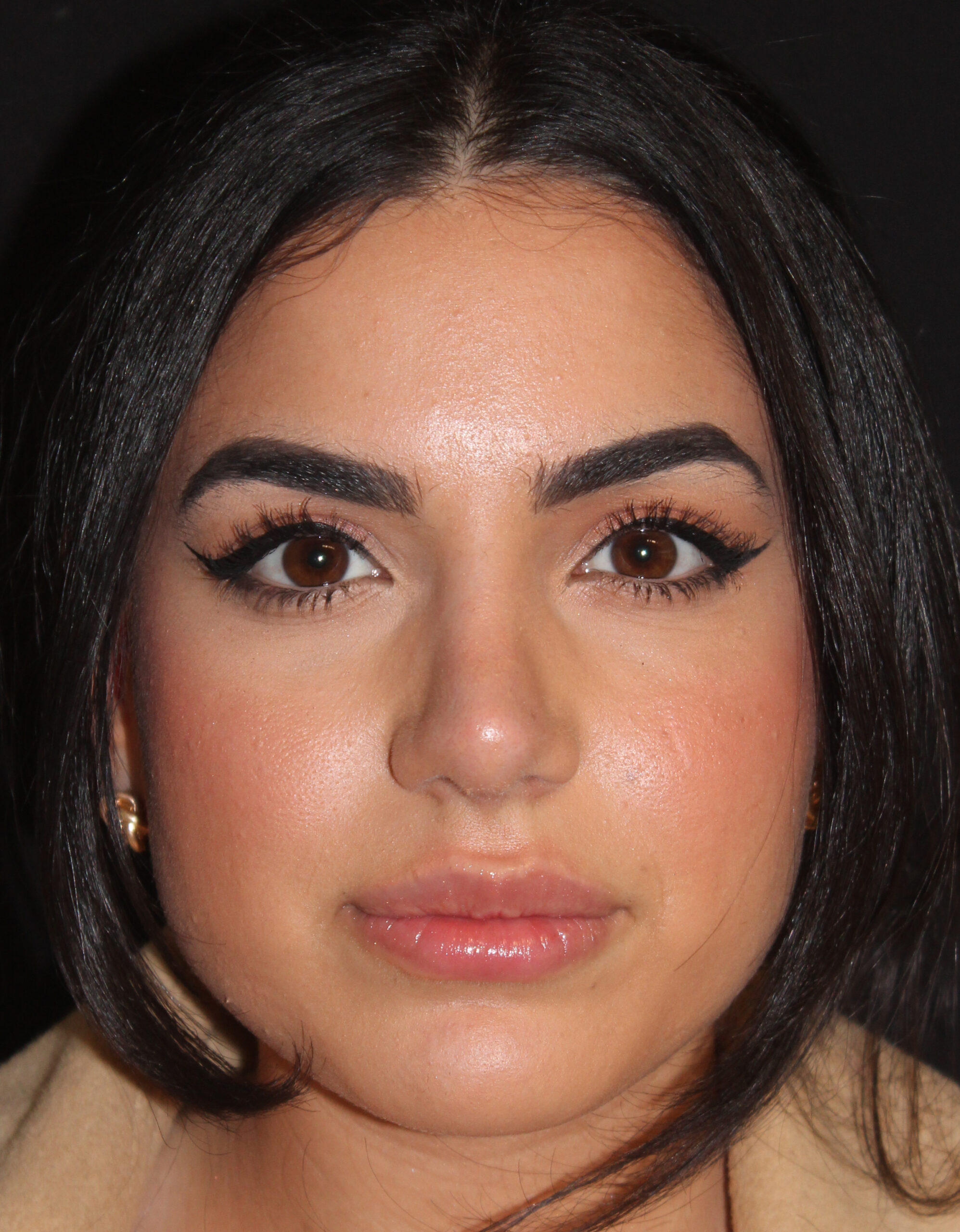 Patient #128 After Image