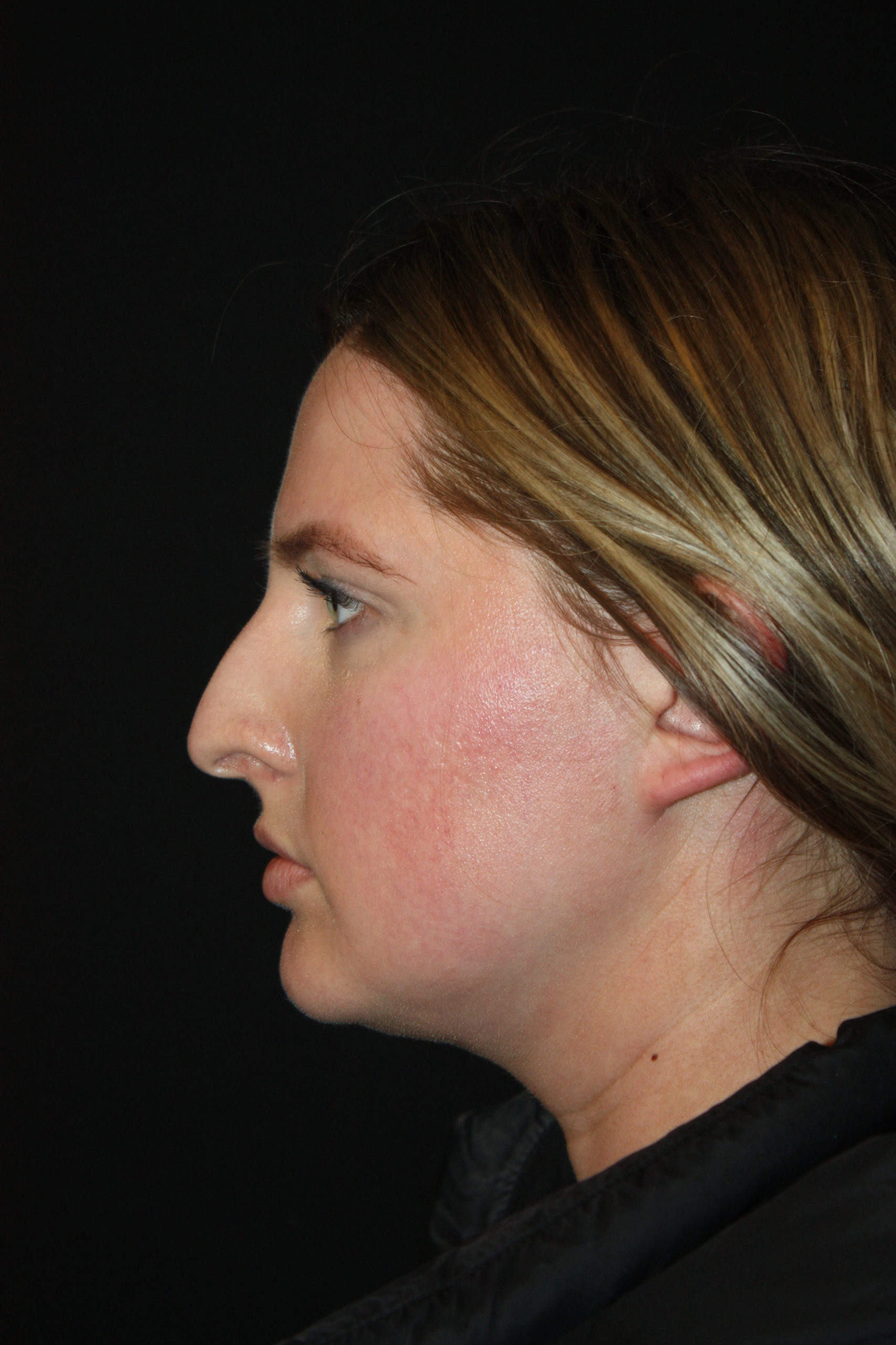 Patient 62 Before Image