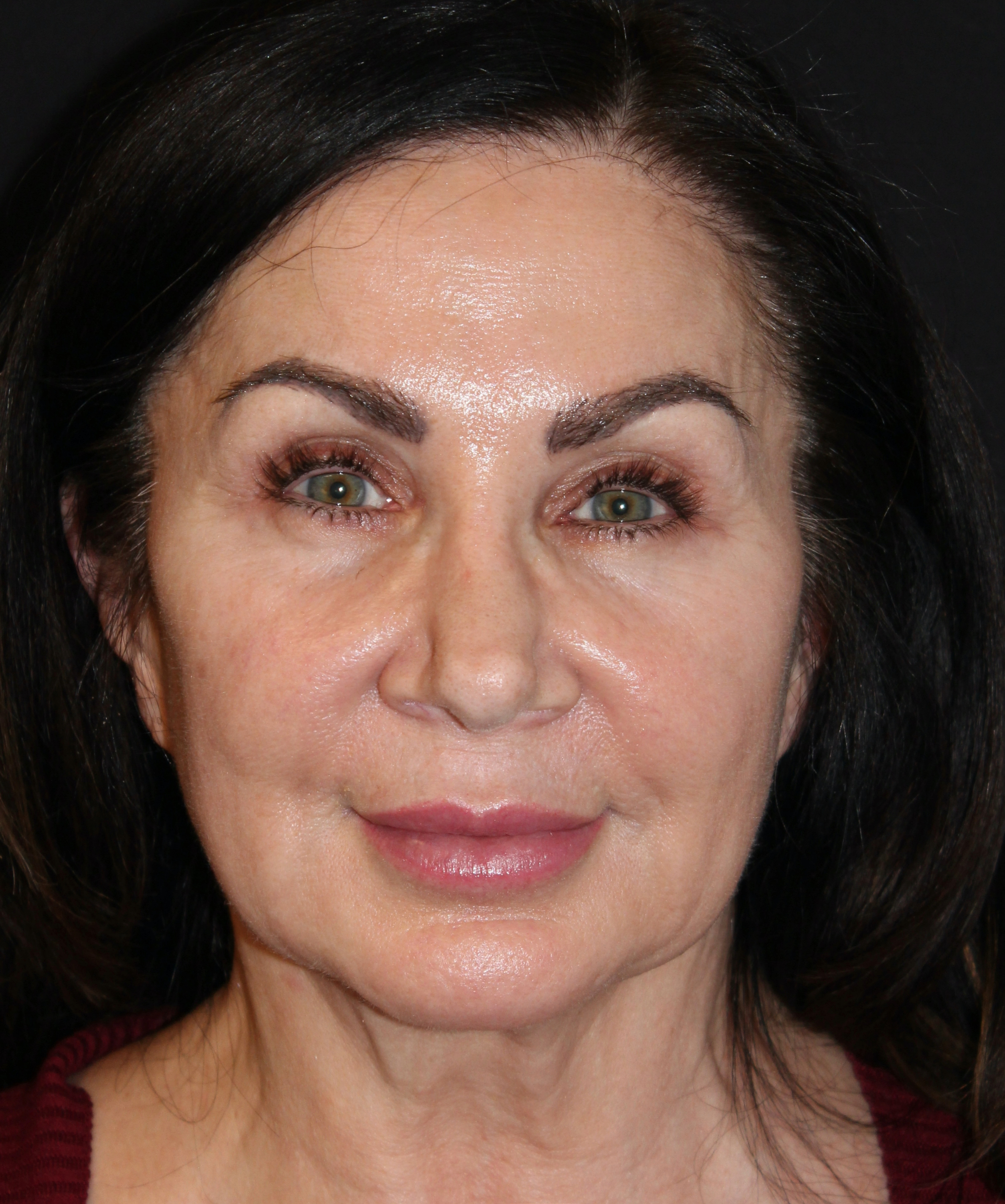 Patient 107 Before Image