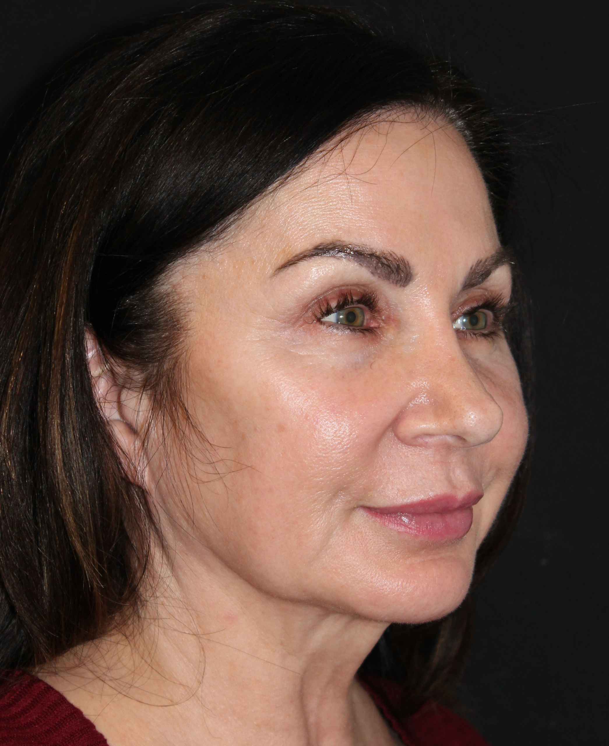 Patient 107 Before Image