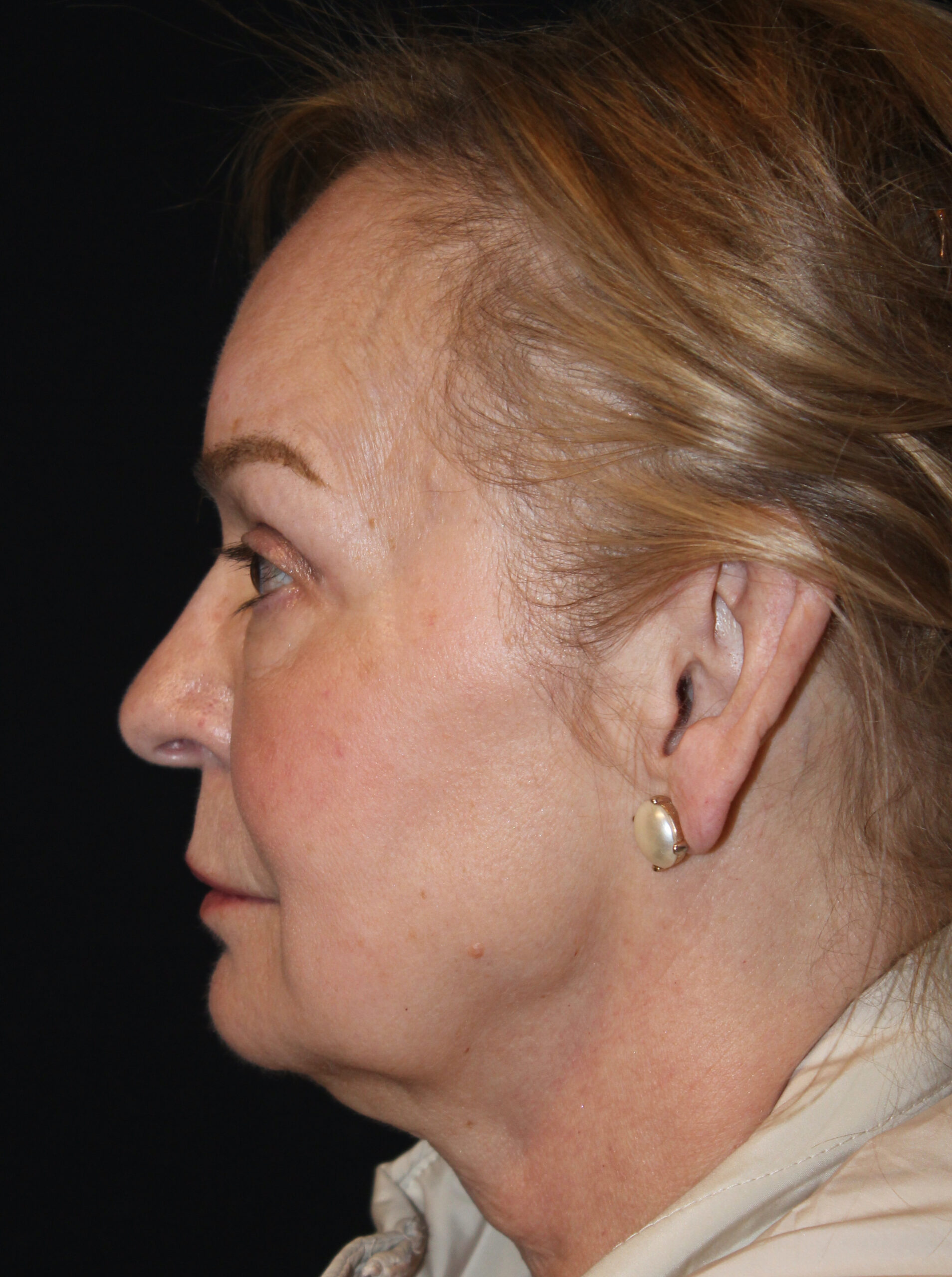 Patient 99 Before Image