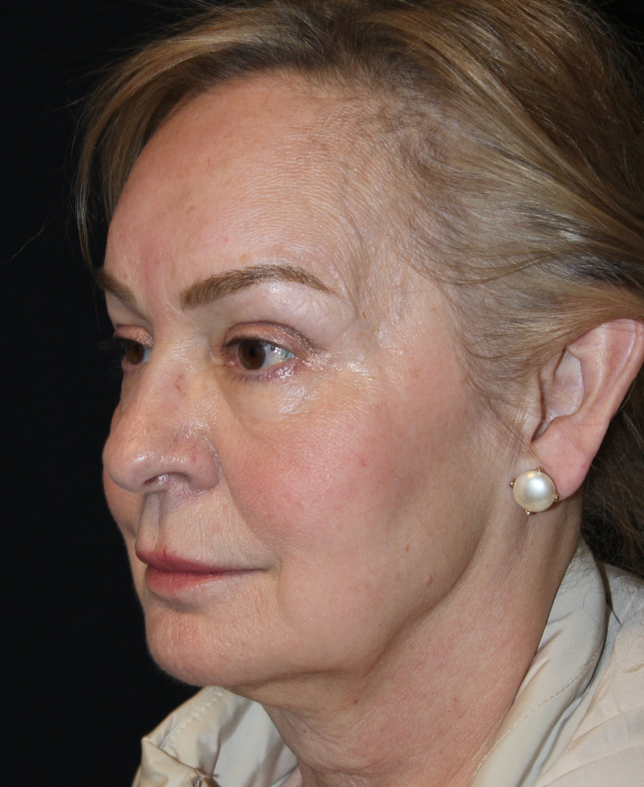 Patient 99 Before Image