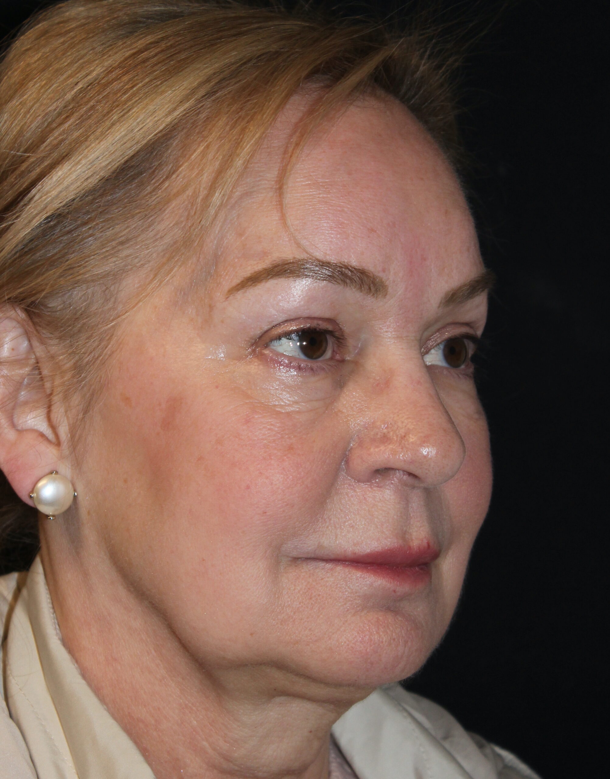 Patient 99 Before Image