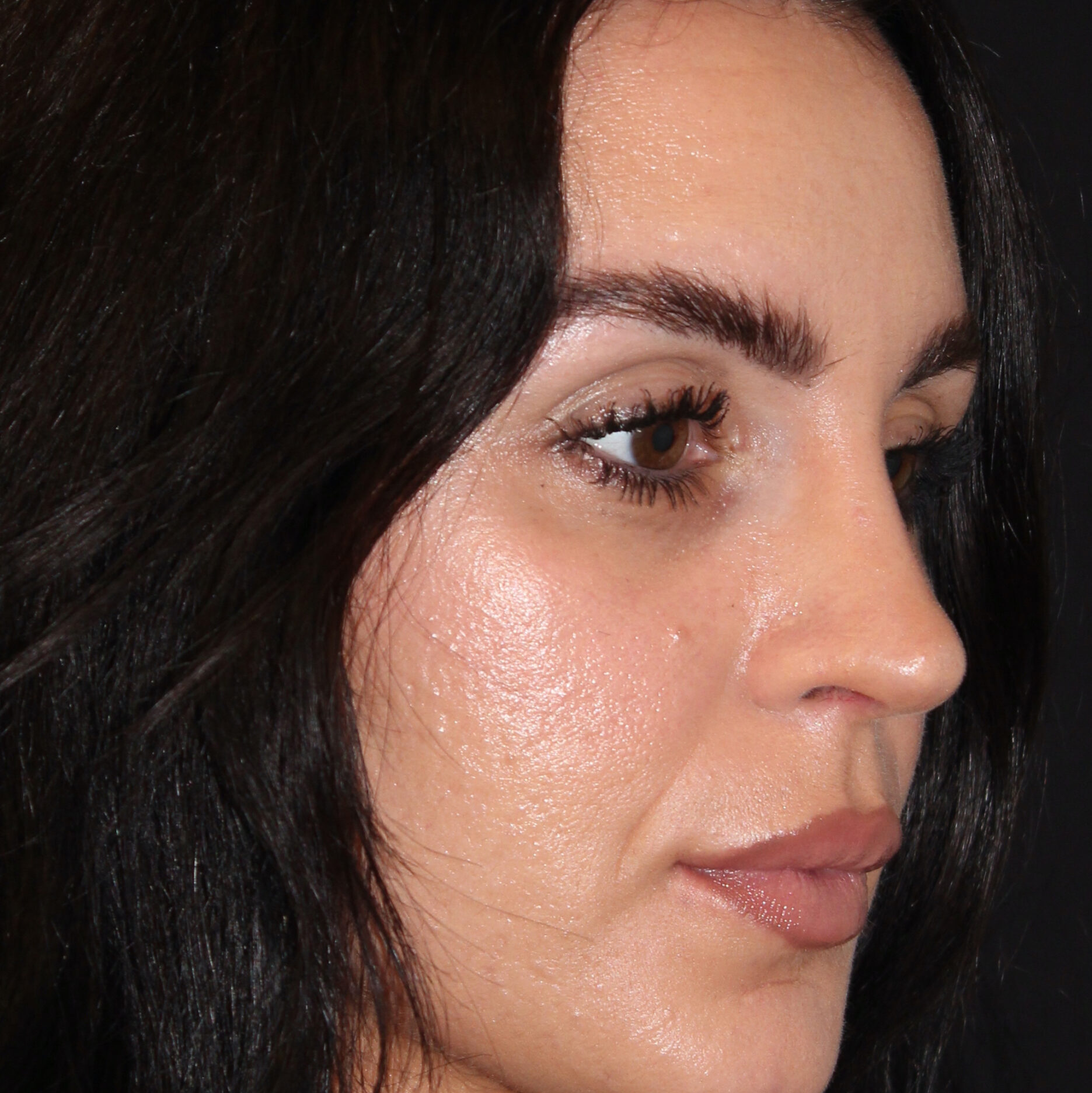 Patient #172 After Image