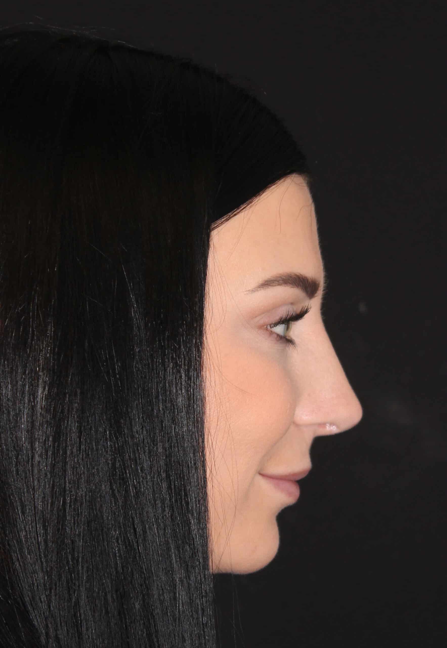 Patient 93 After Image