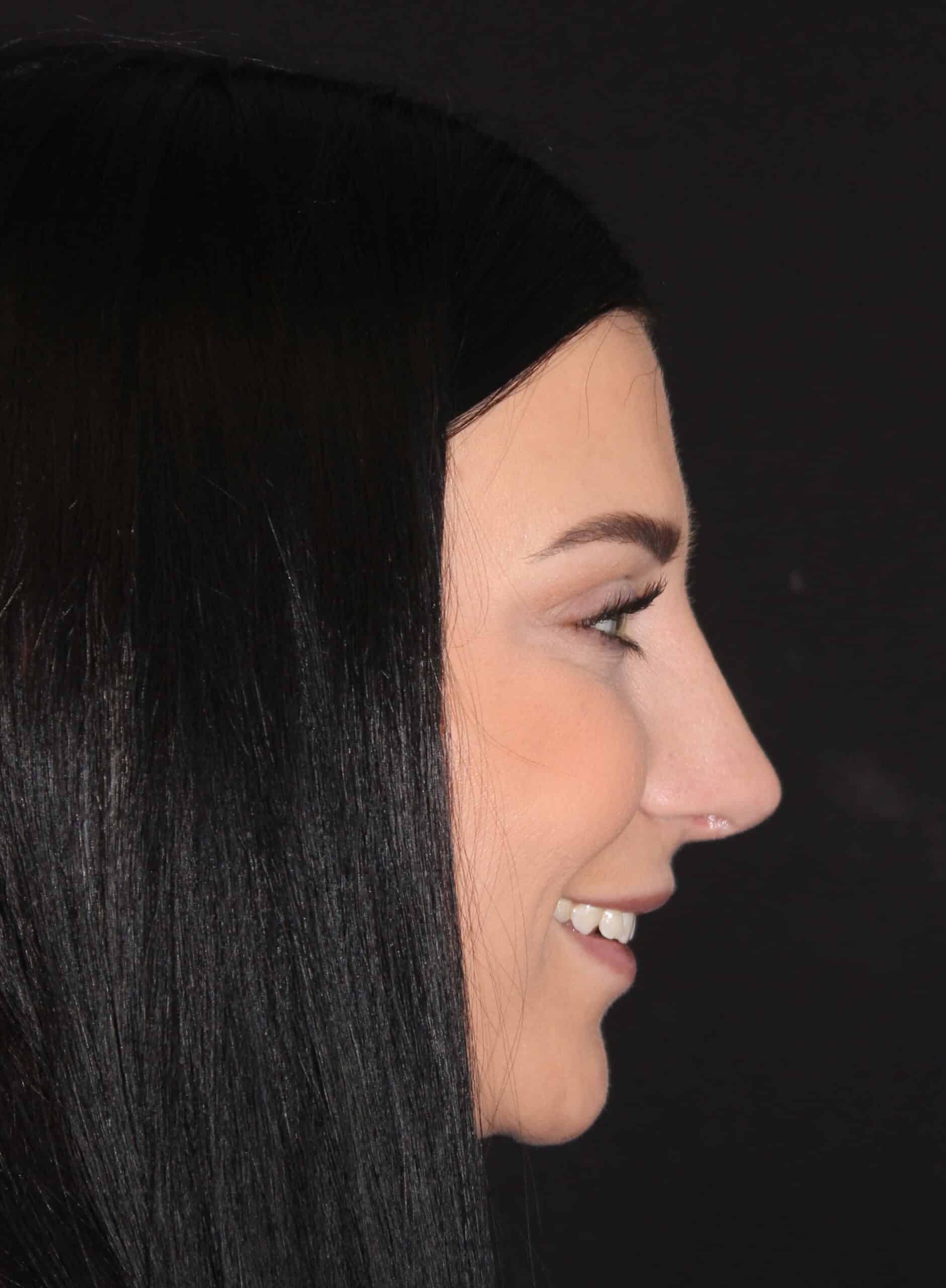 Patient 93 After Image