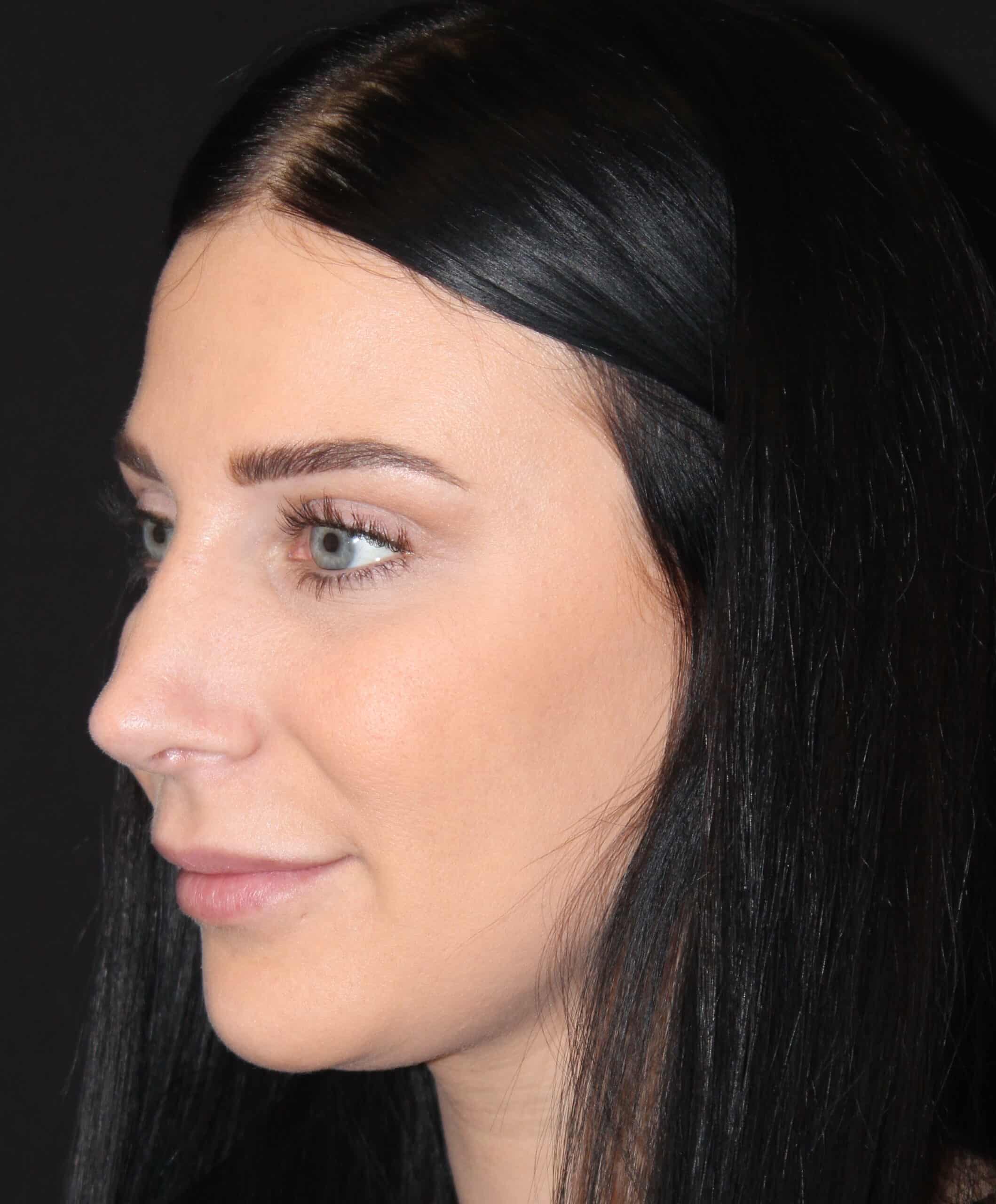 Patient 93 After Image